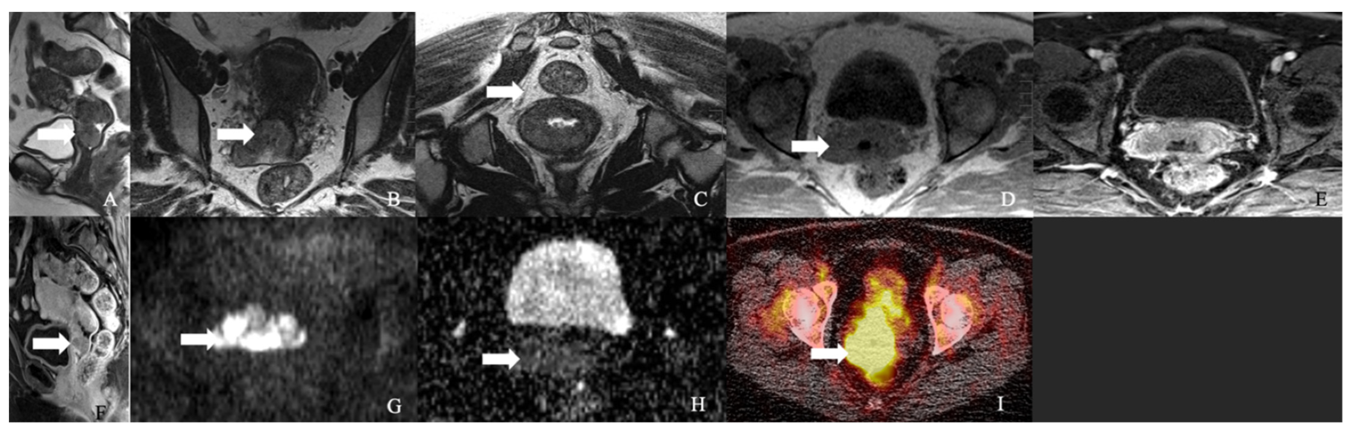 Cancers 14 01835 g003 550