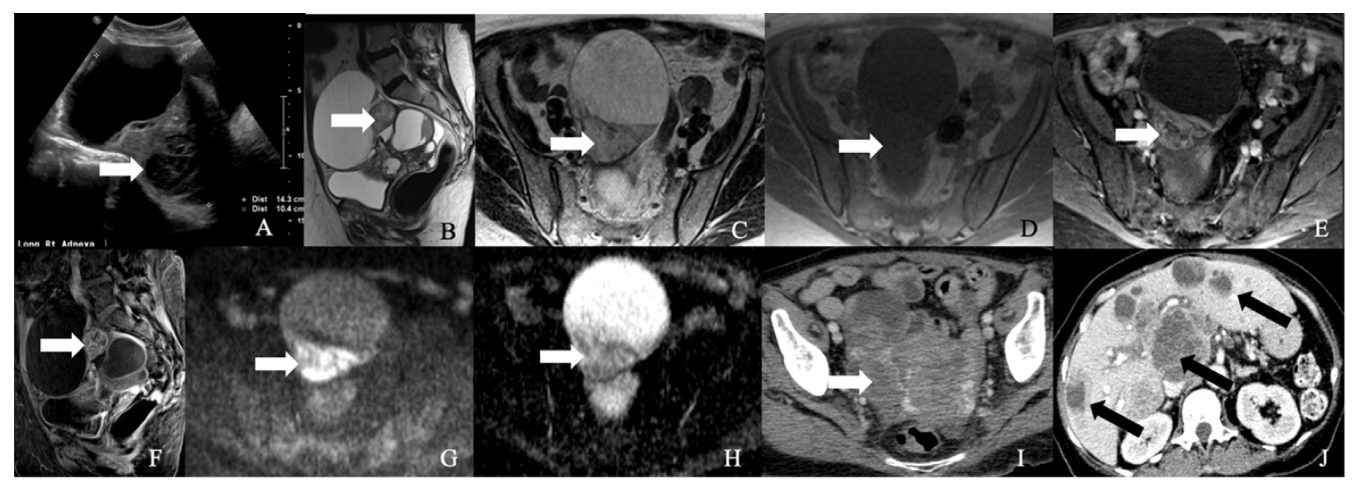 Cancers 14 01835 g007 550
