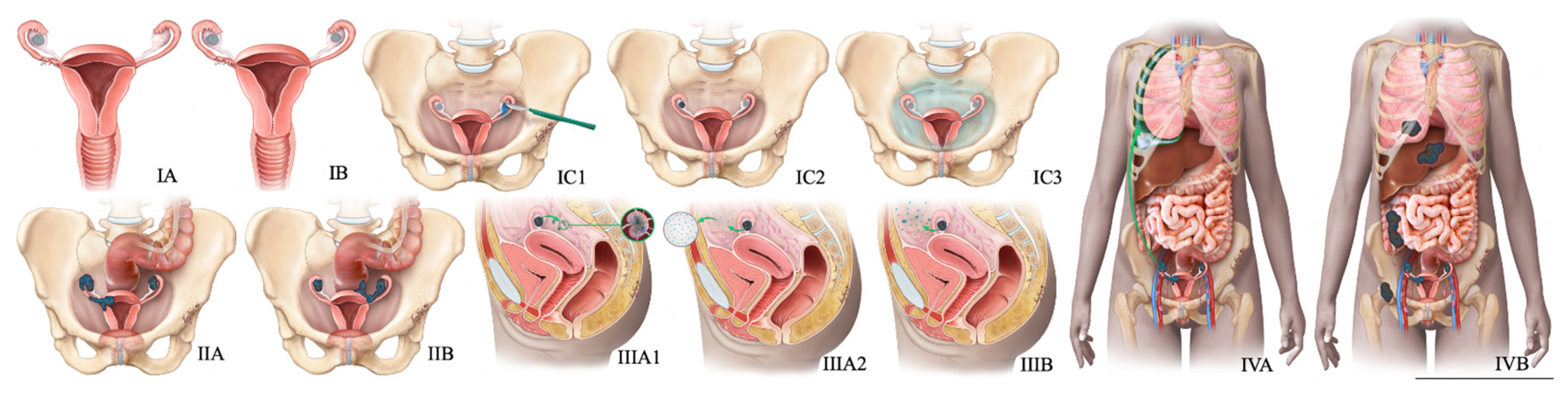 Cancers 14 01835 g008 550