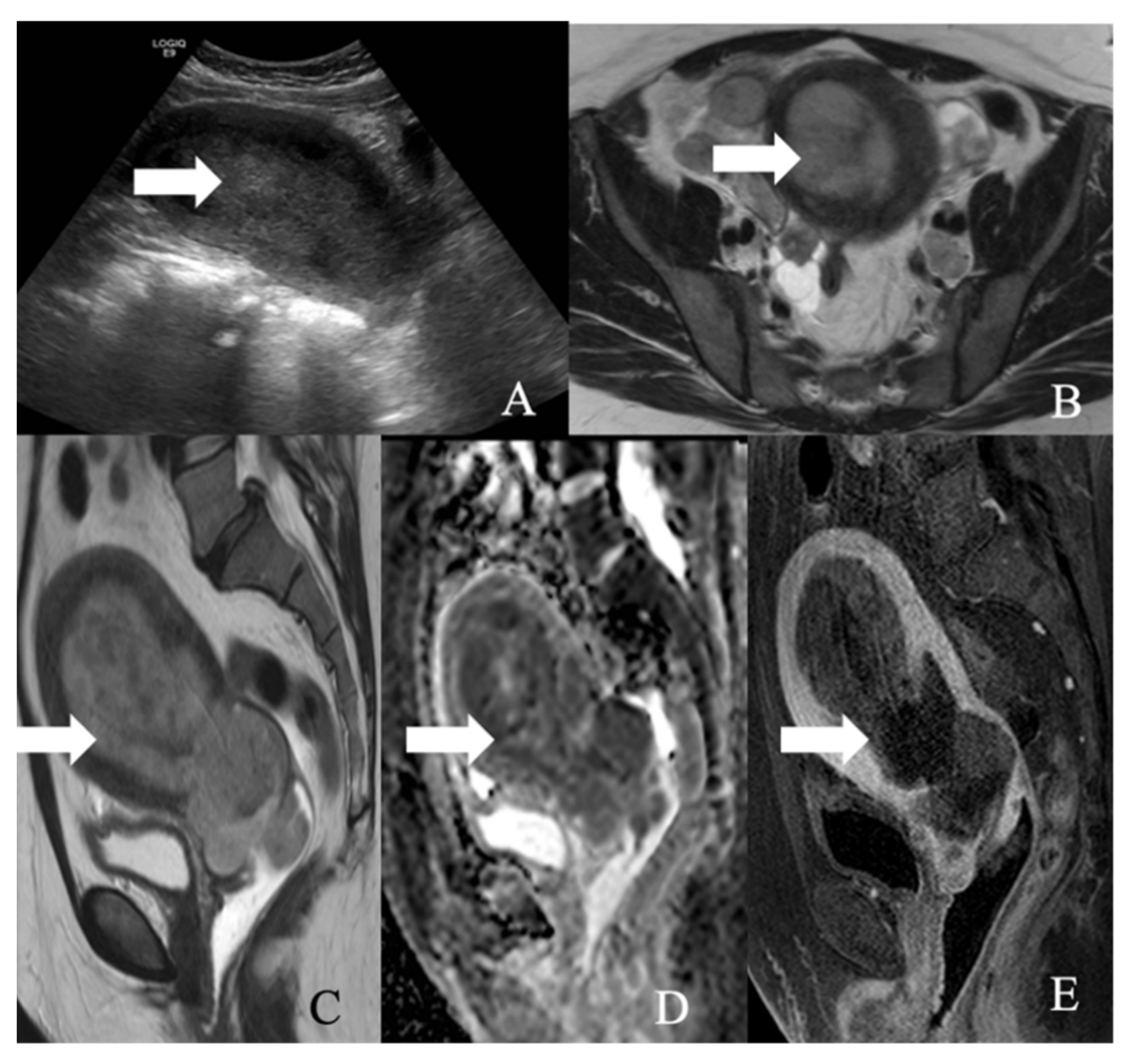 Cancers 14 01835 g011 550