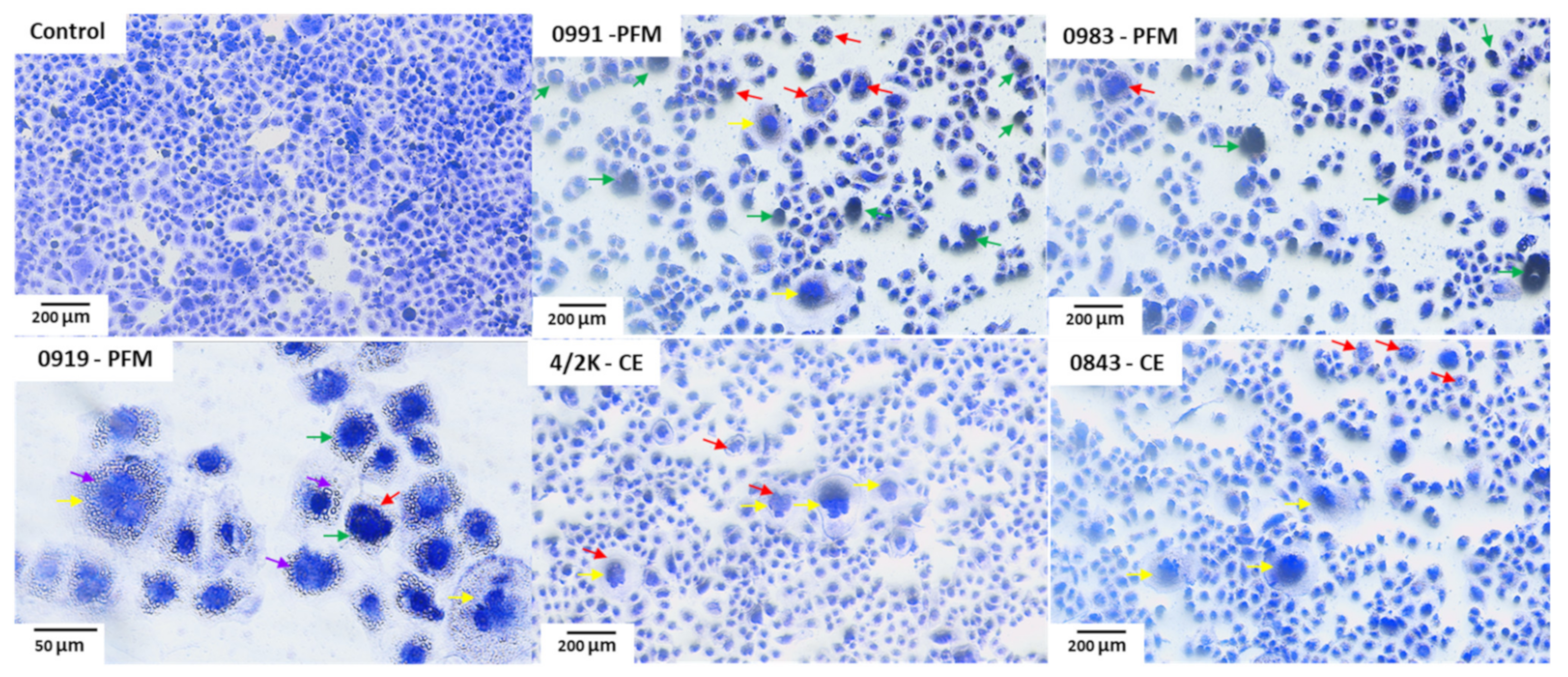 Cancers 14 01853 g007