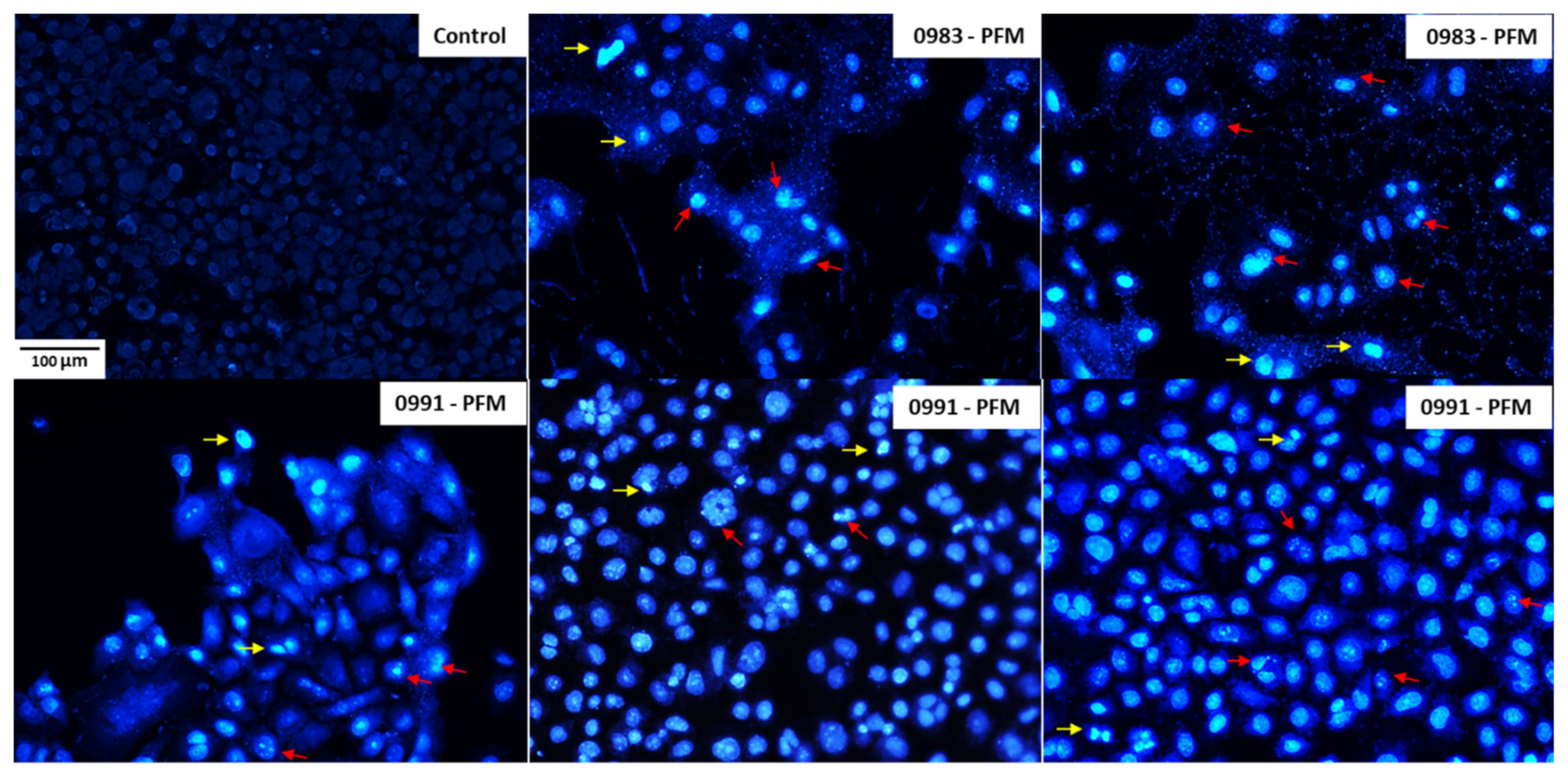 Cancers 14 01853 g008