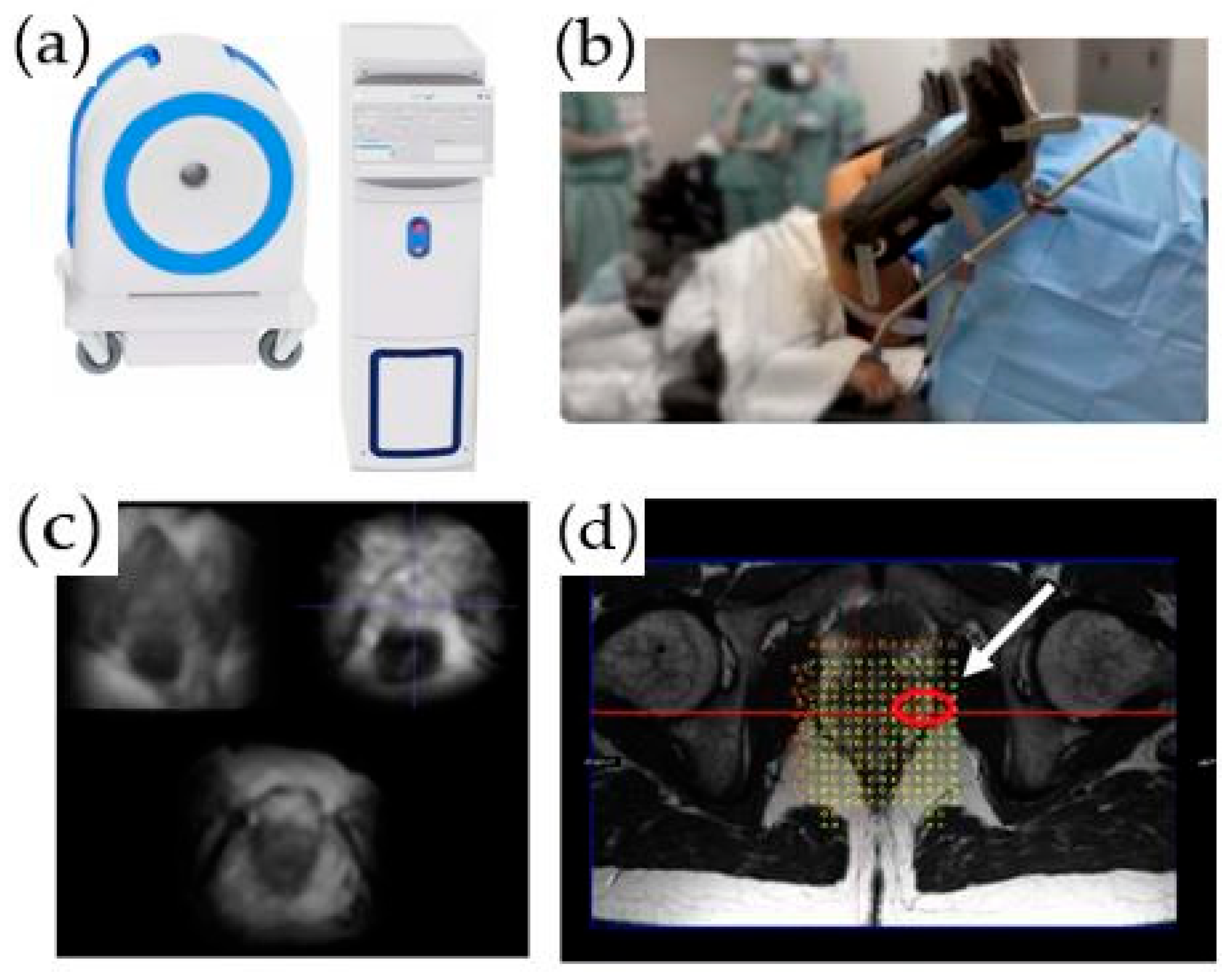 Cancers 14 01860 g002 550