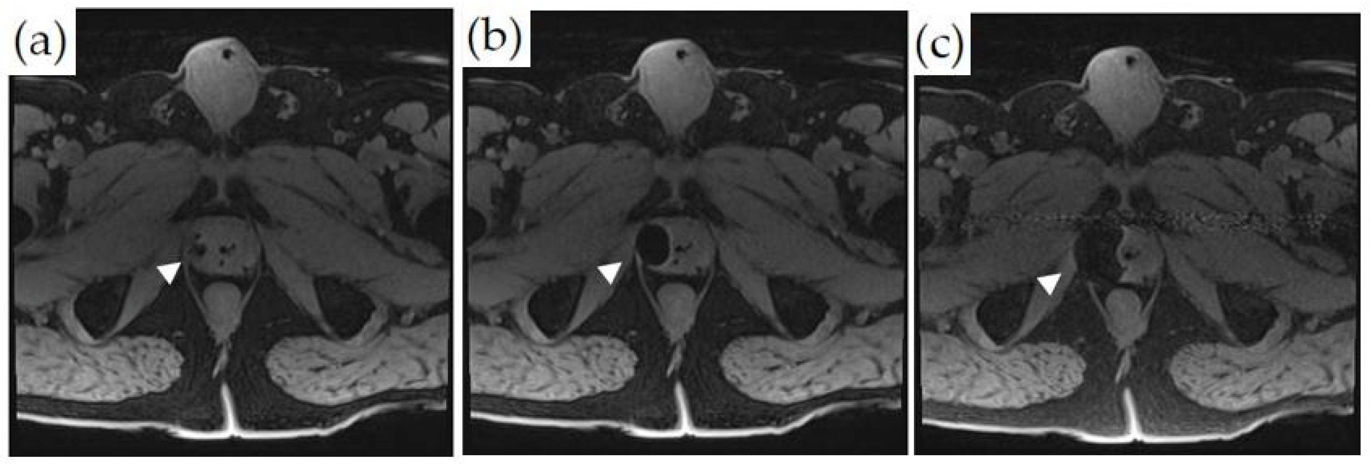 Cancers 14 01860 g006 550