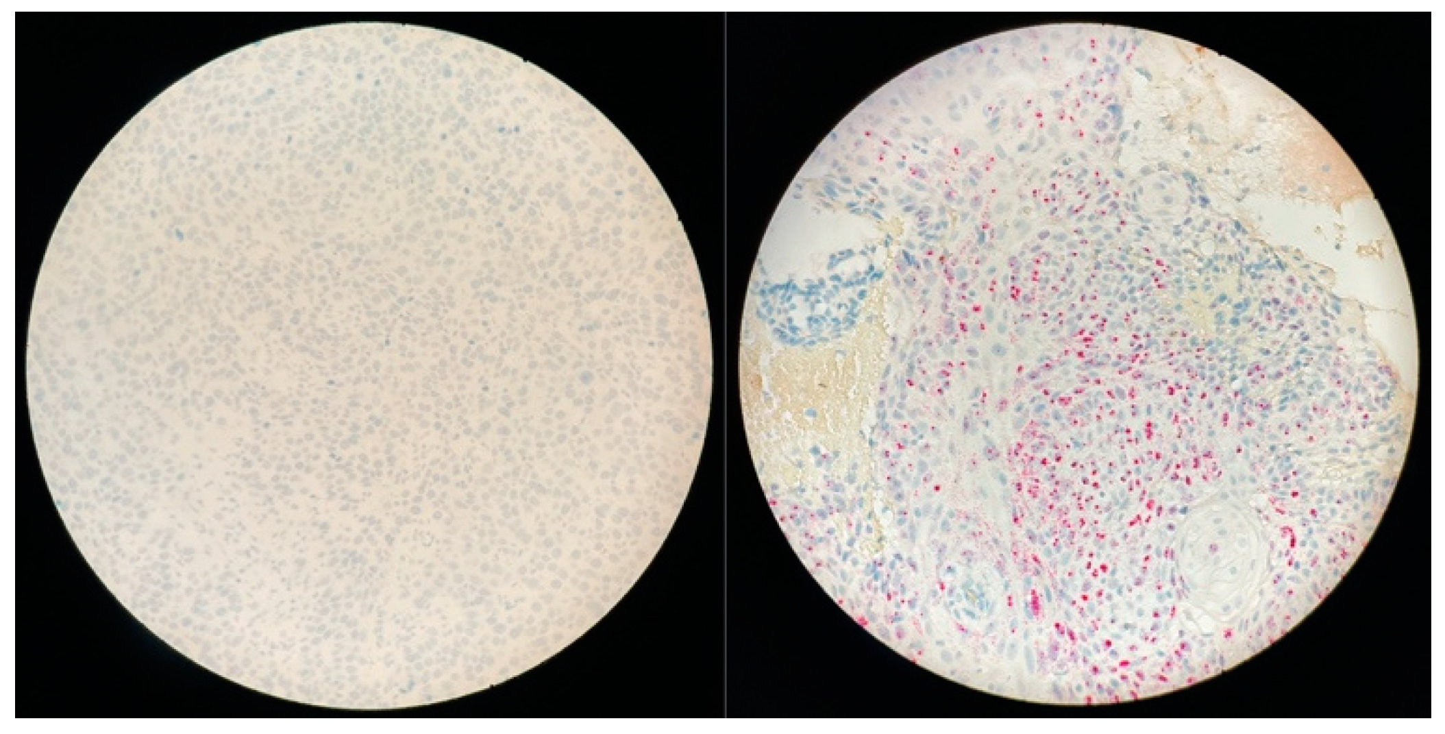 Cancers 14 01874 g003