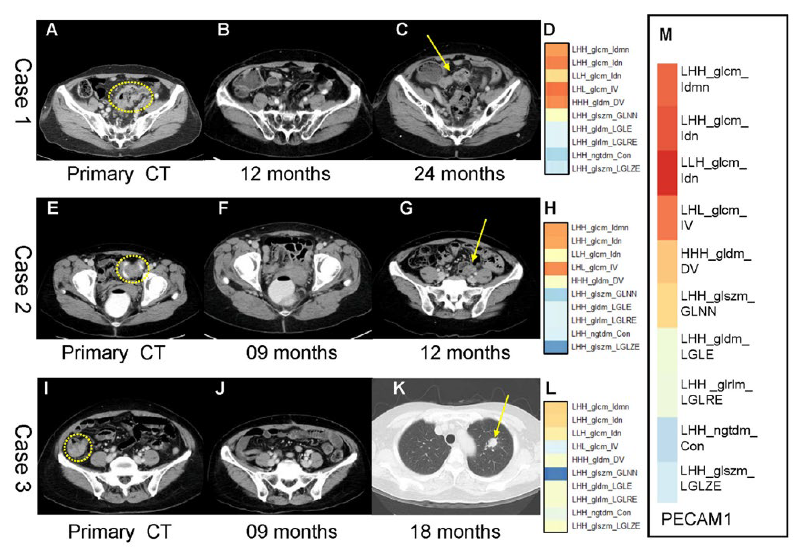 Cancers 14 01895 g005