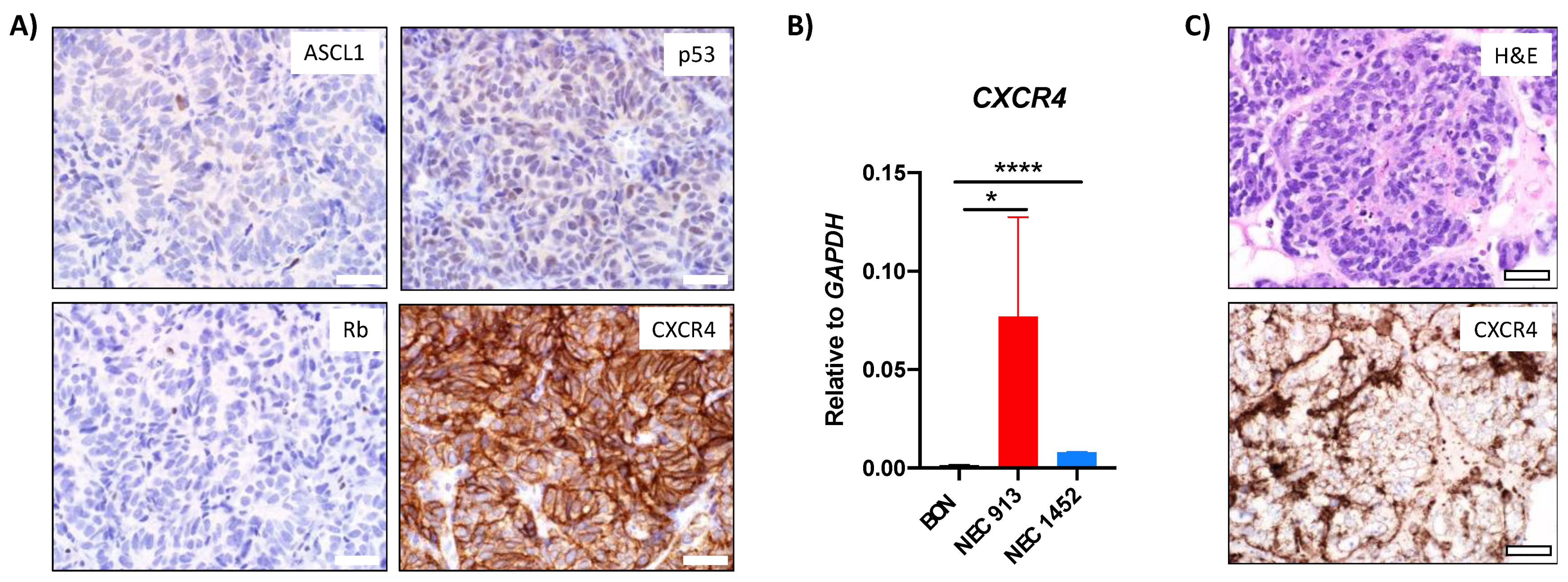 Cancers 14 01910 g005 Cancers 14 01910 g005
