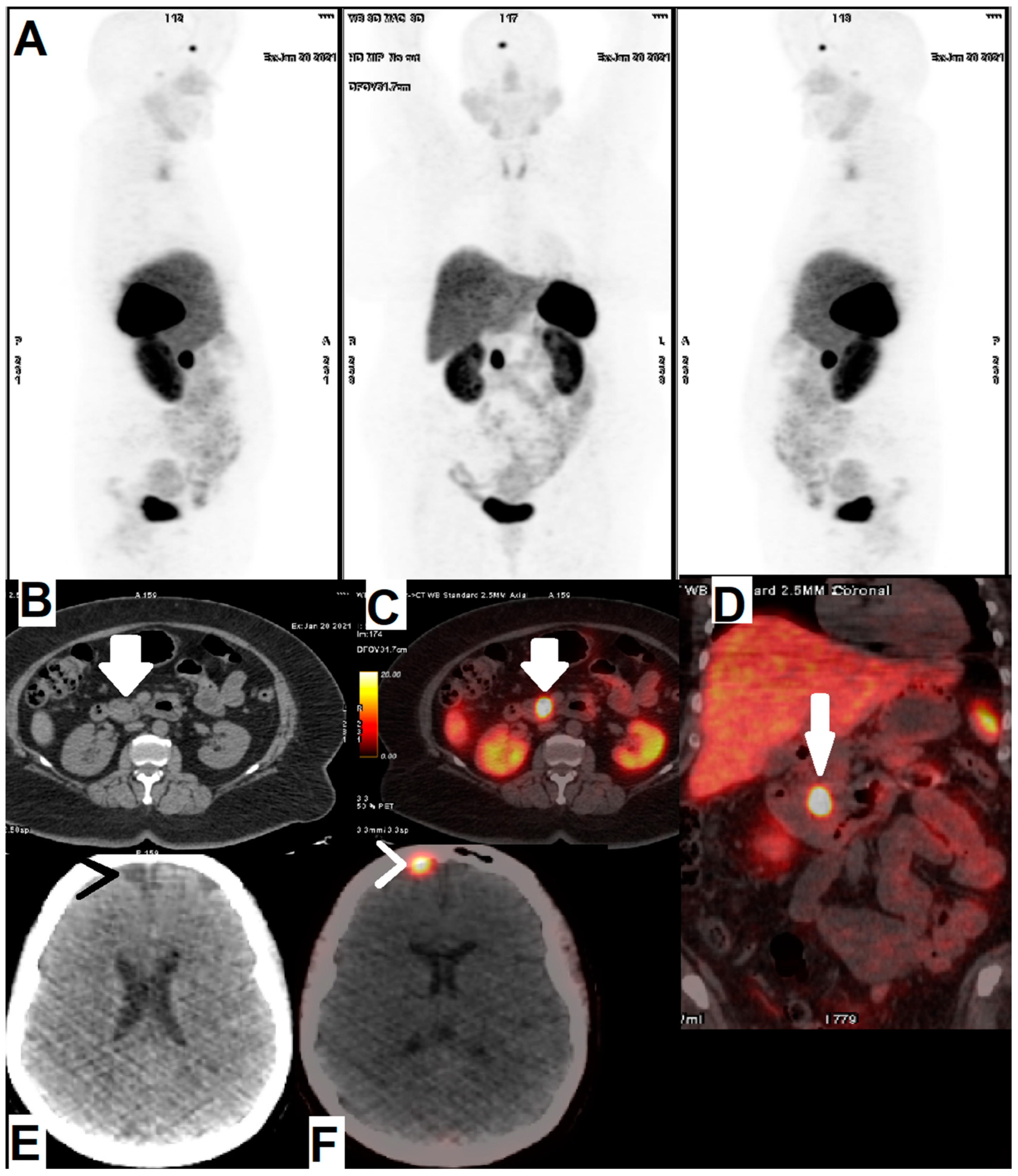 Cancers 14 01914 g002