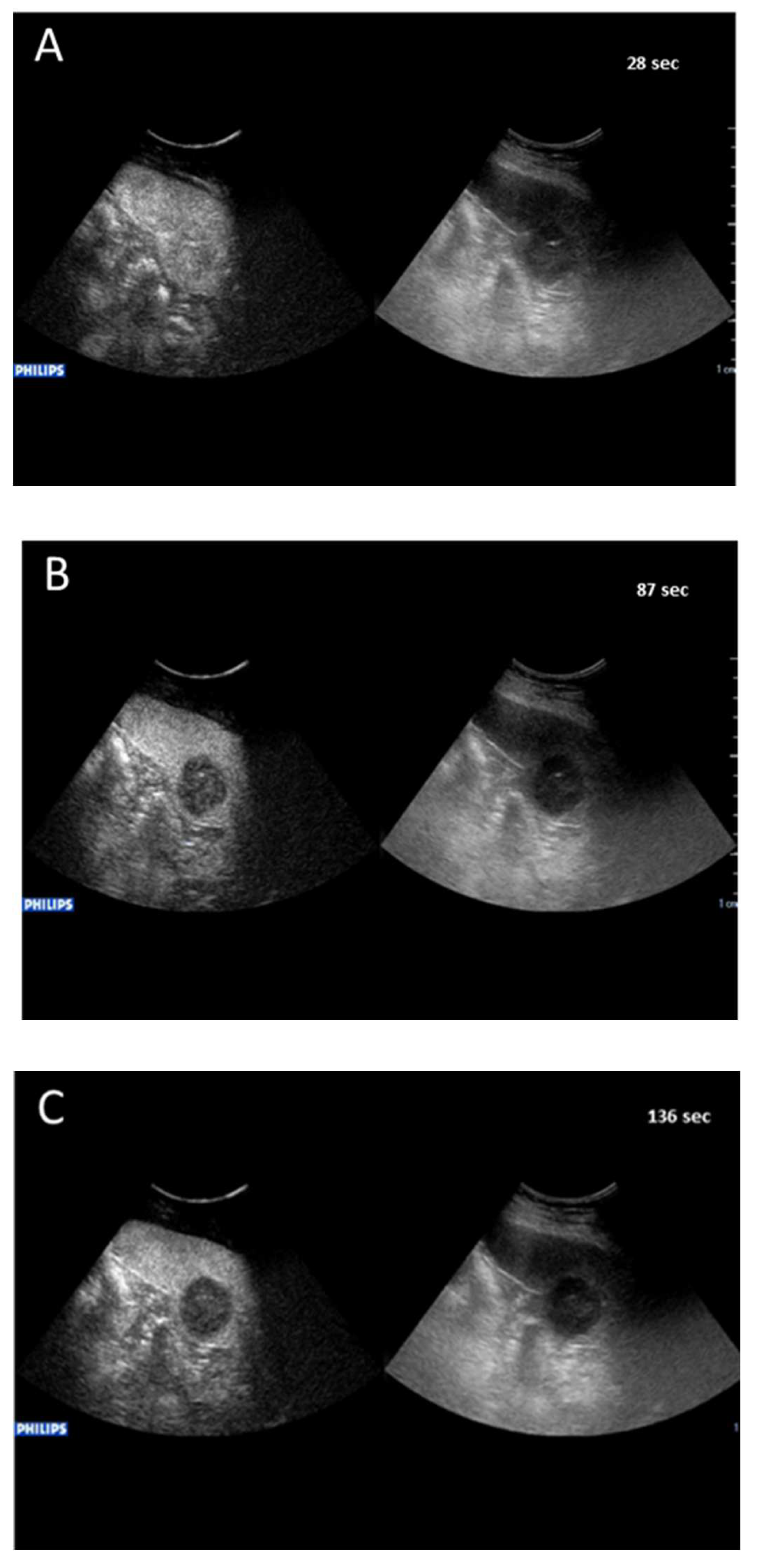 Cancers 14 01927 g002