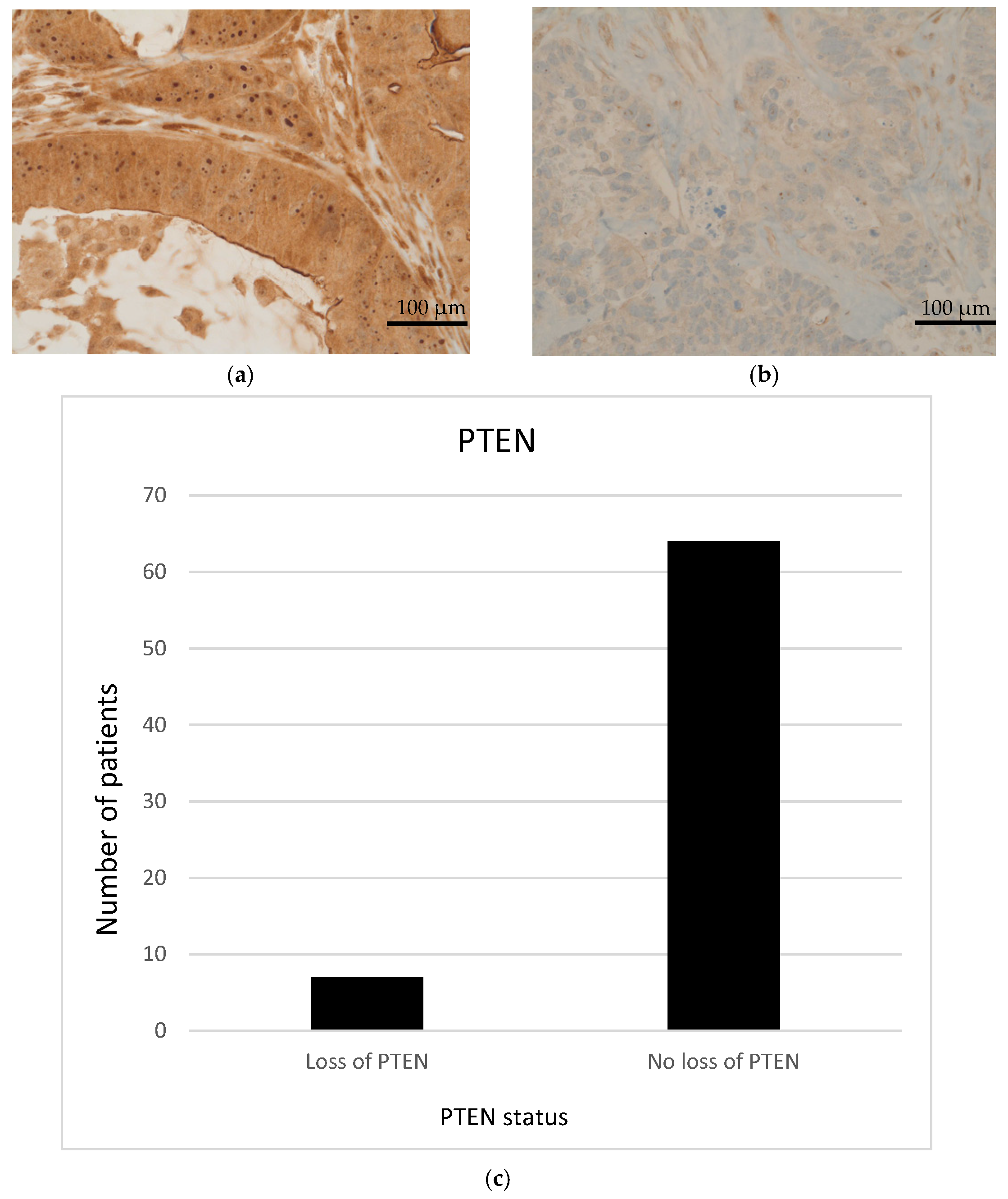 Cancers 14 01936 g003 550