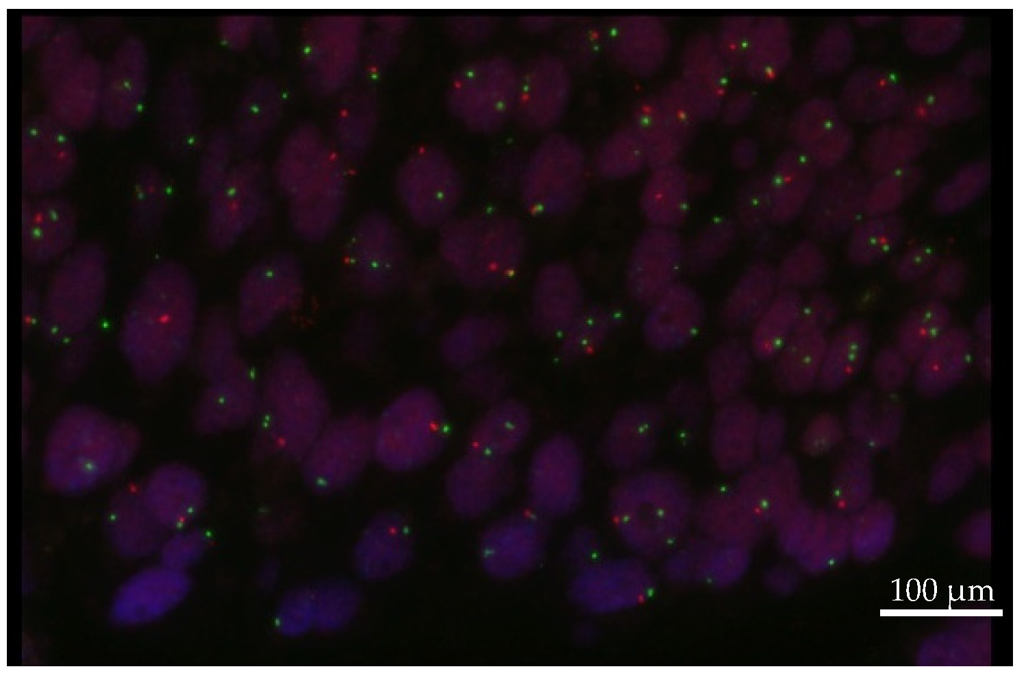 Cancers 14 01936 g004 550