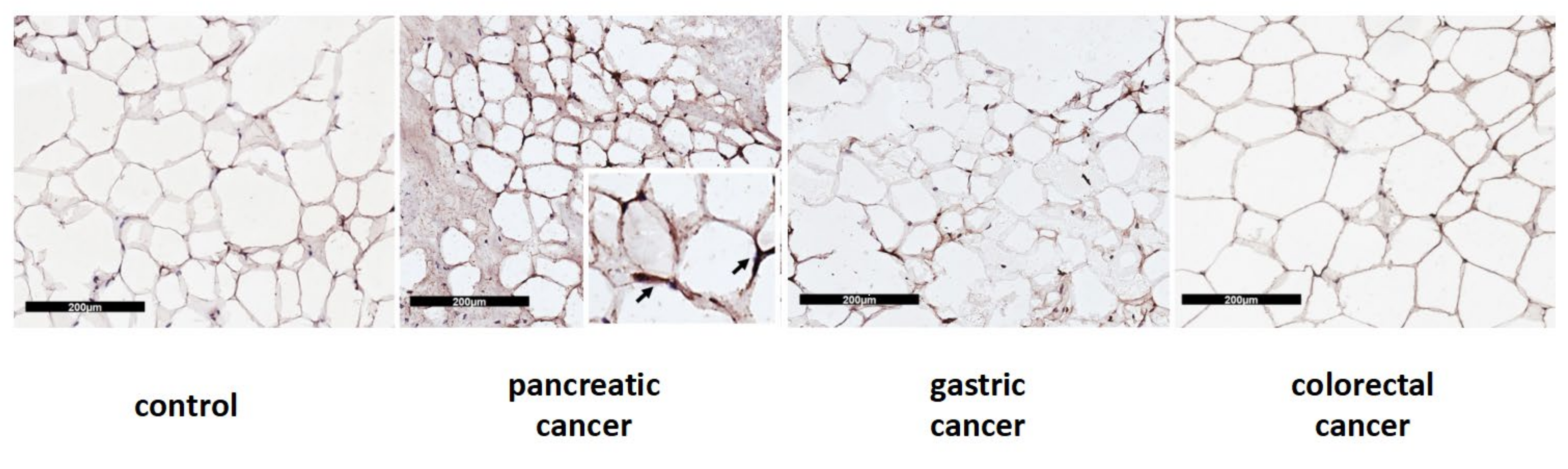 Cancers 14 01948 g004