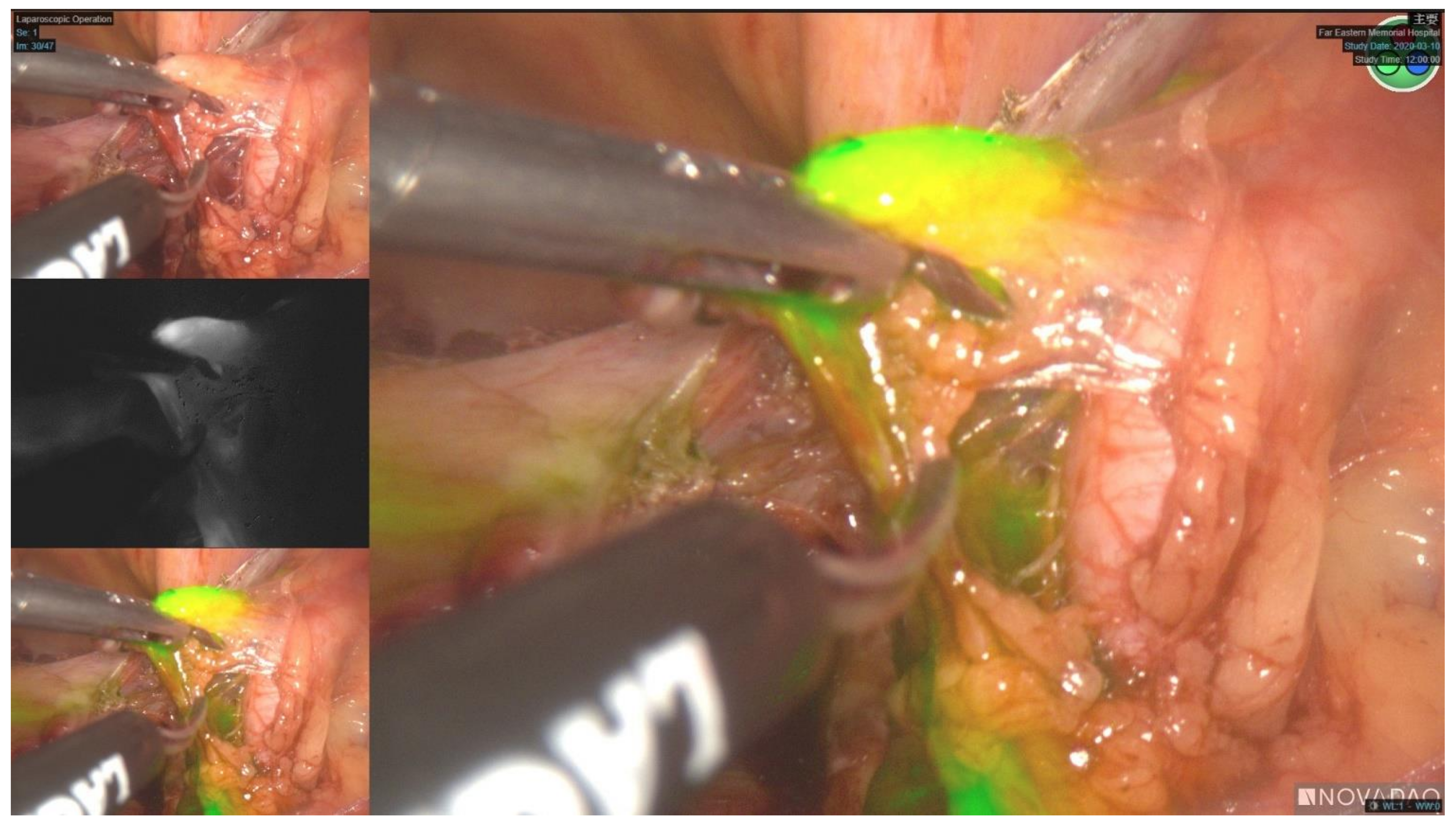 Cancers 14 01973 g001