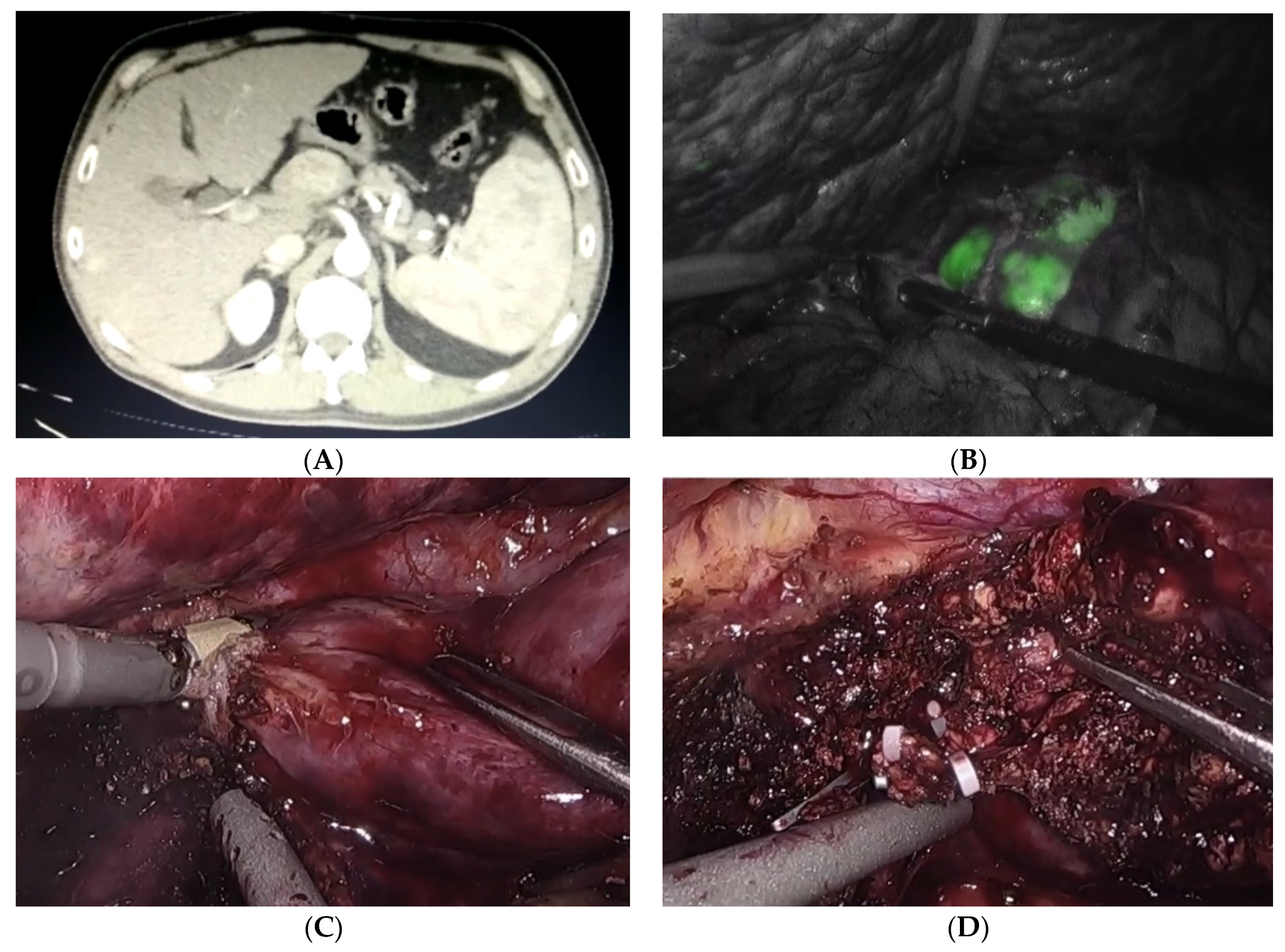 Cancers 14 02012 g001