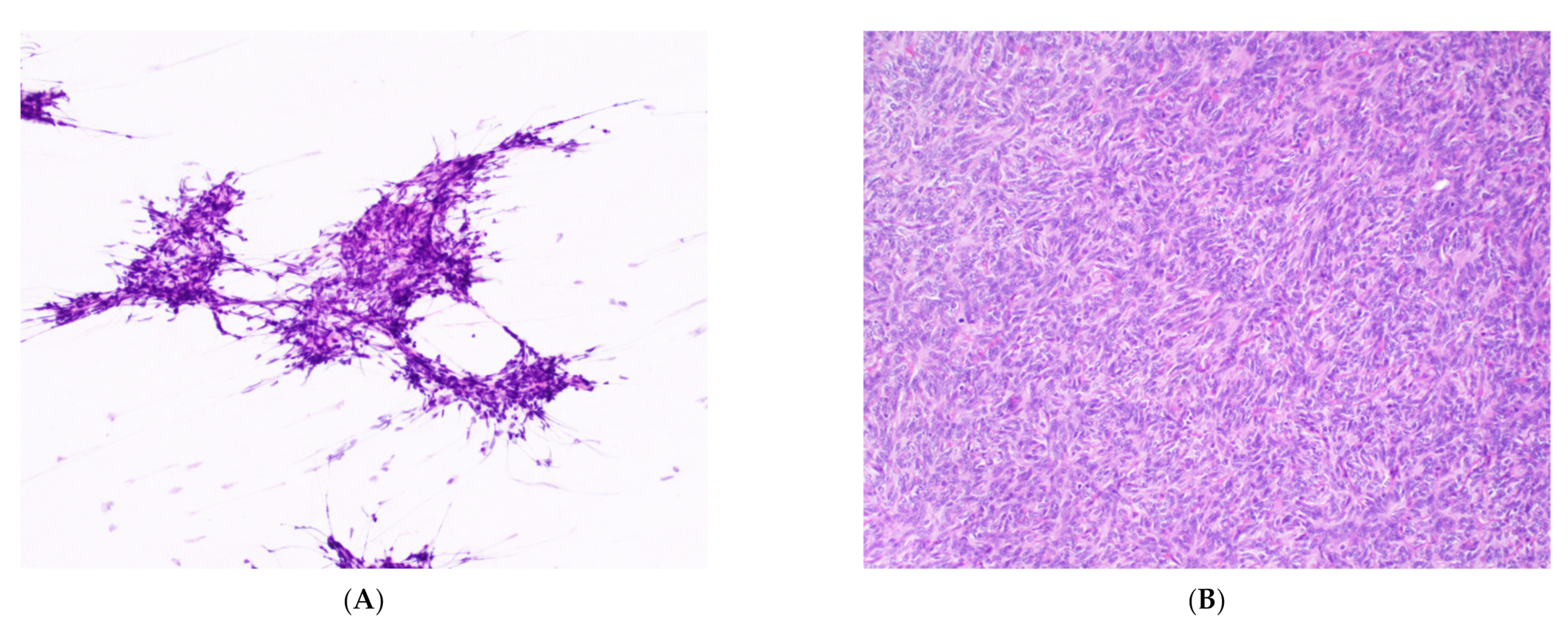 Cancers 14 02013 g003