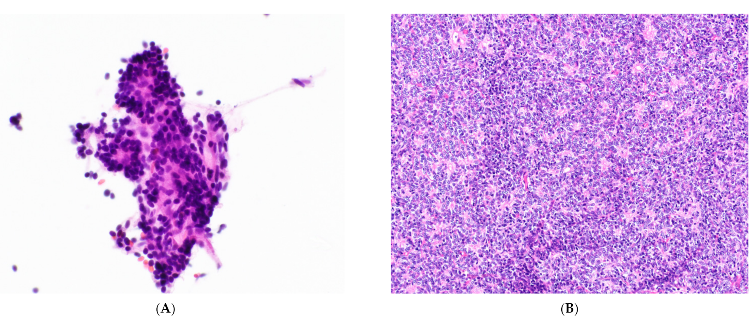 Cancers 14 02013 g004