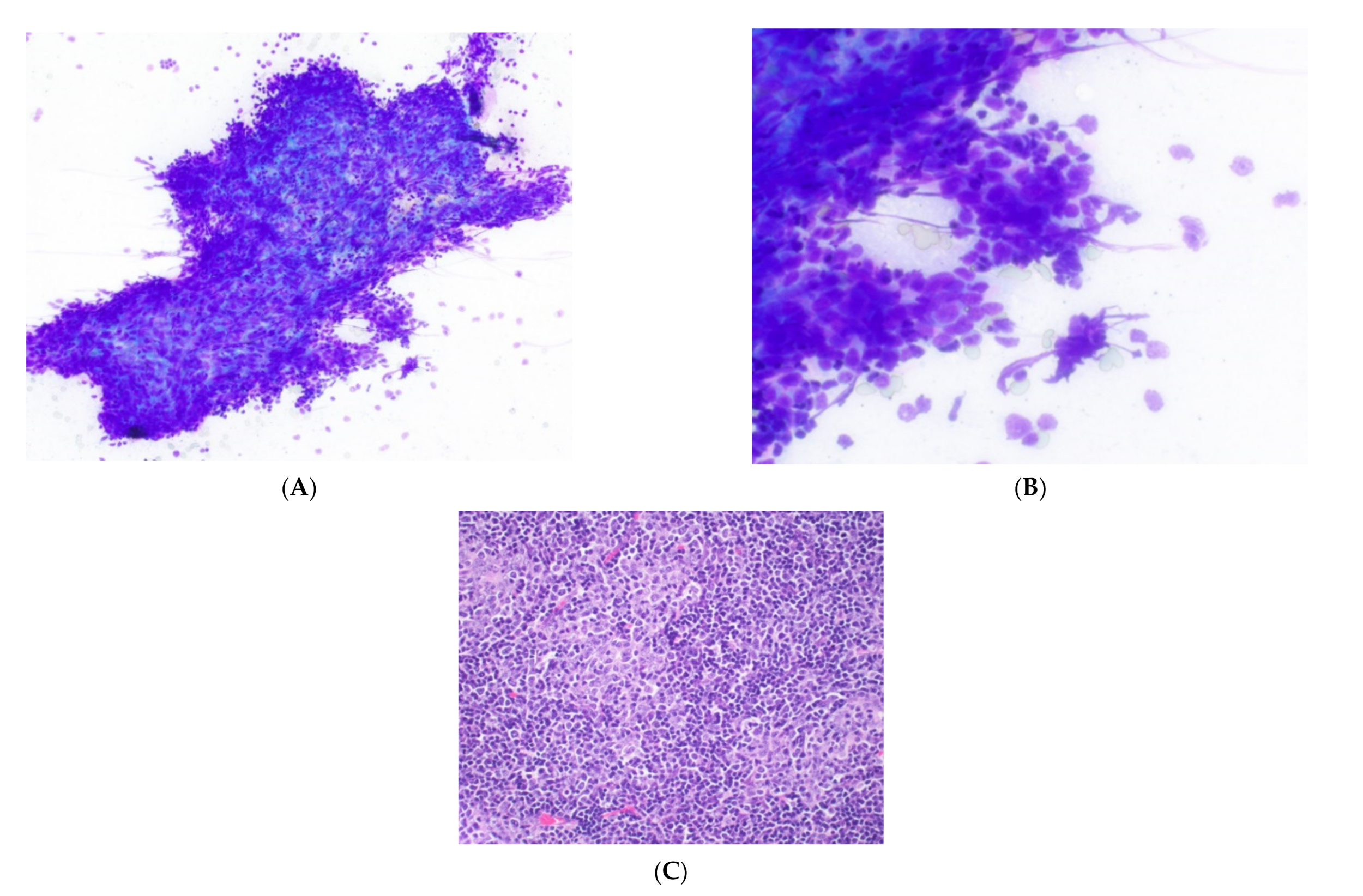 Cancers 14 02013 g005