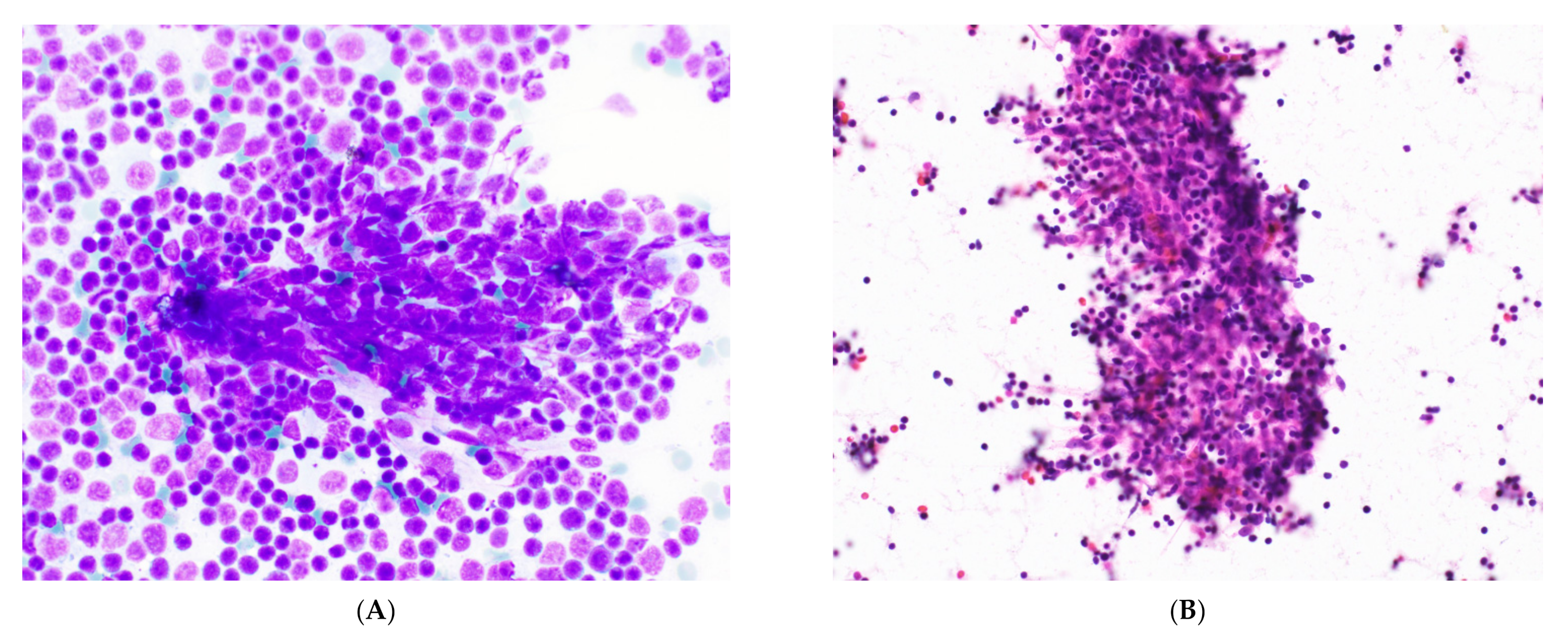 Cancers 14 02013 g006