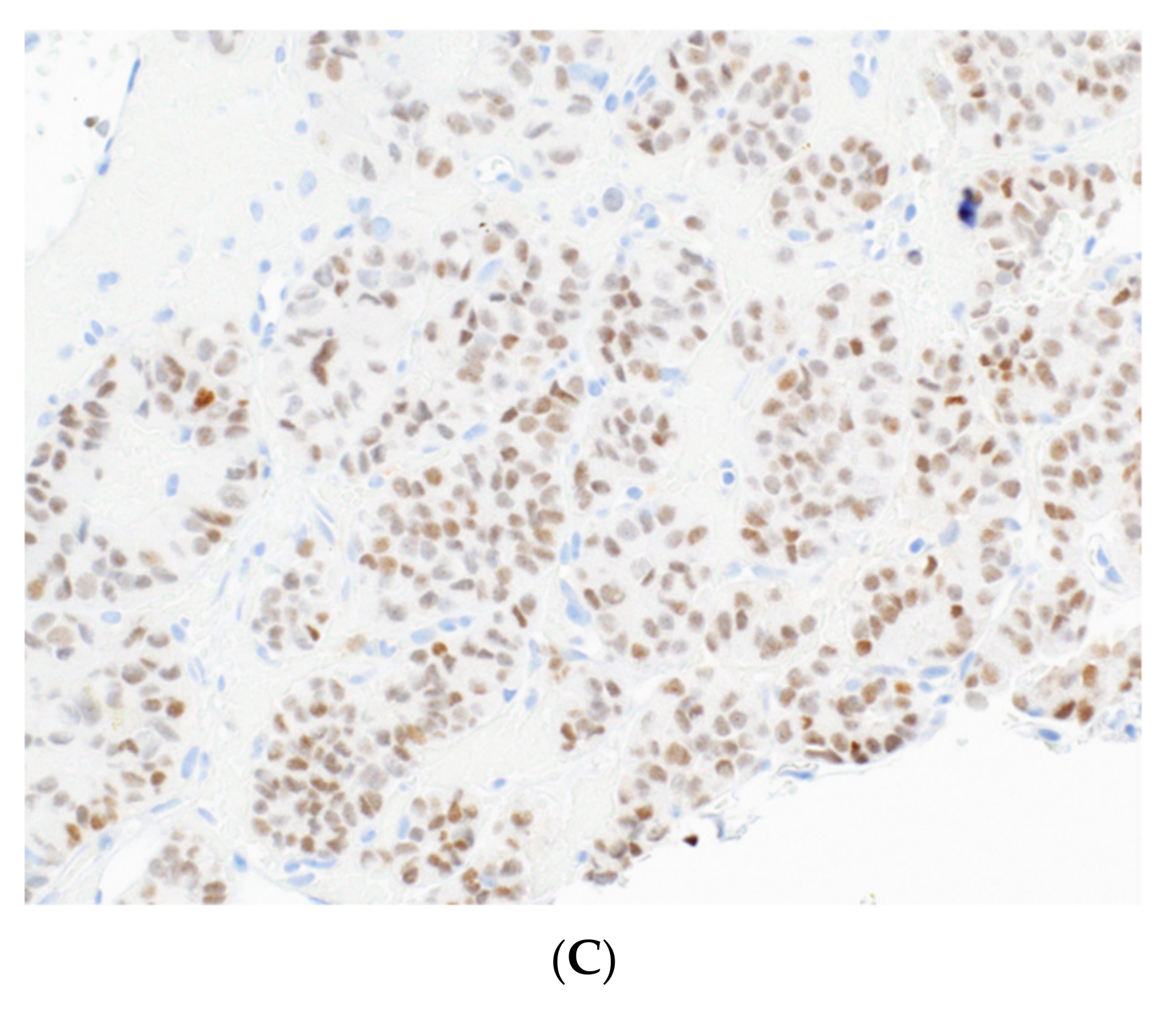 Cancers 14 02013 g009b