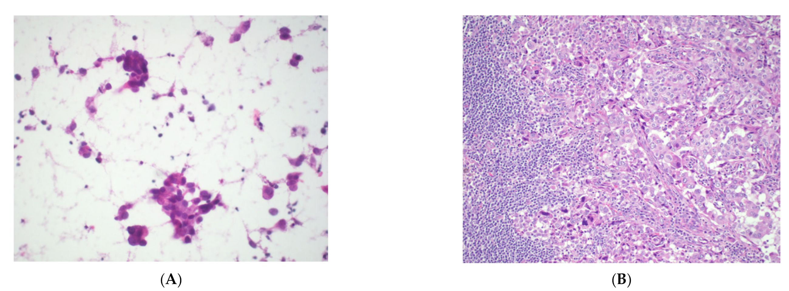 Cancers 14 02013 g010a