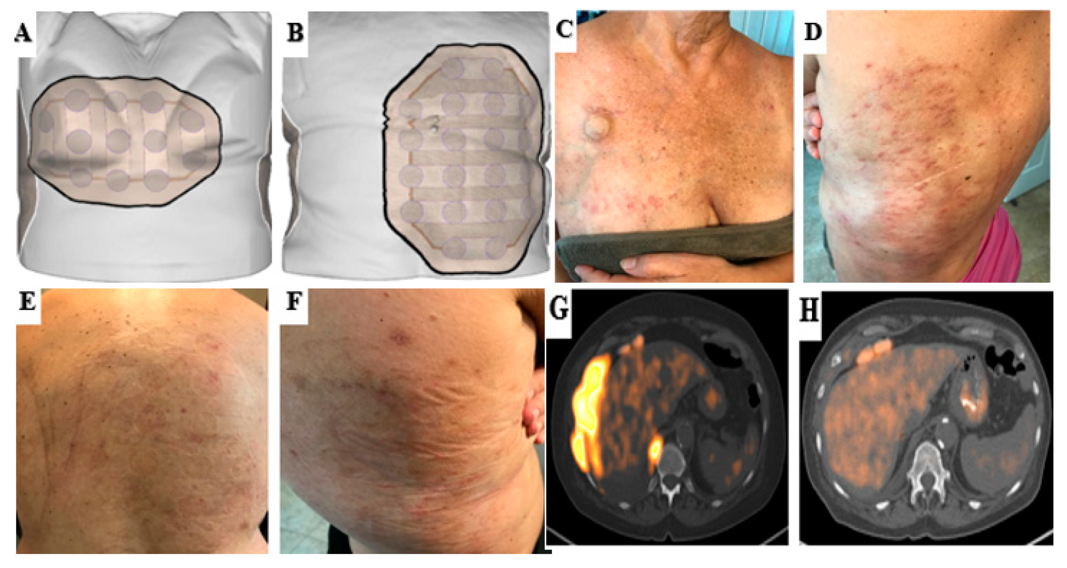 Cancers 14 02020 g003