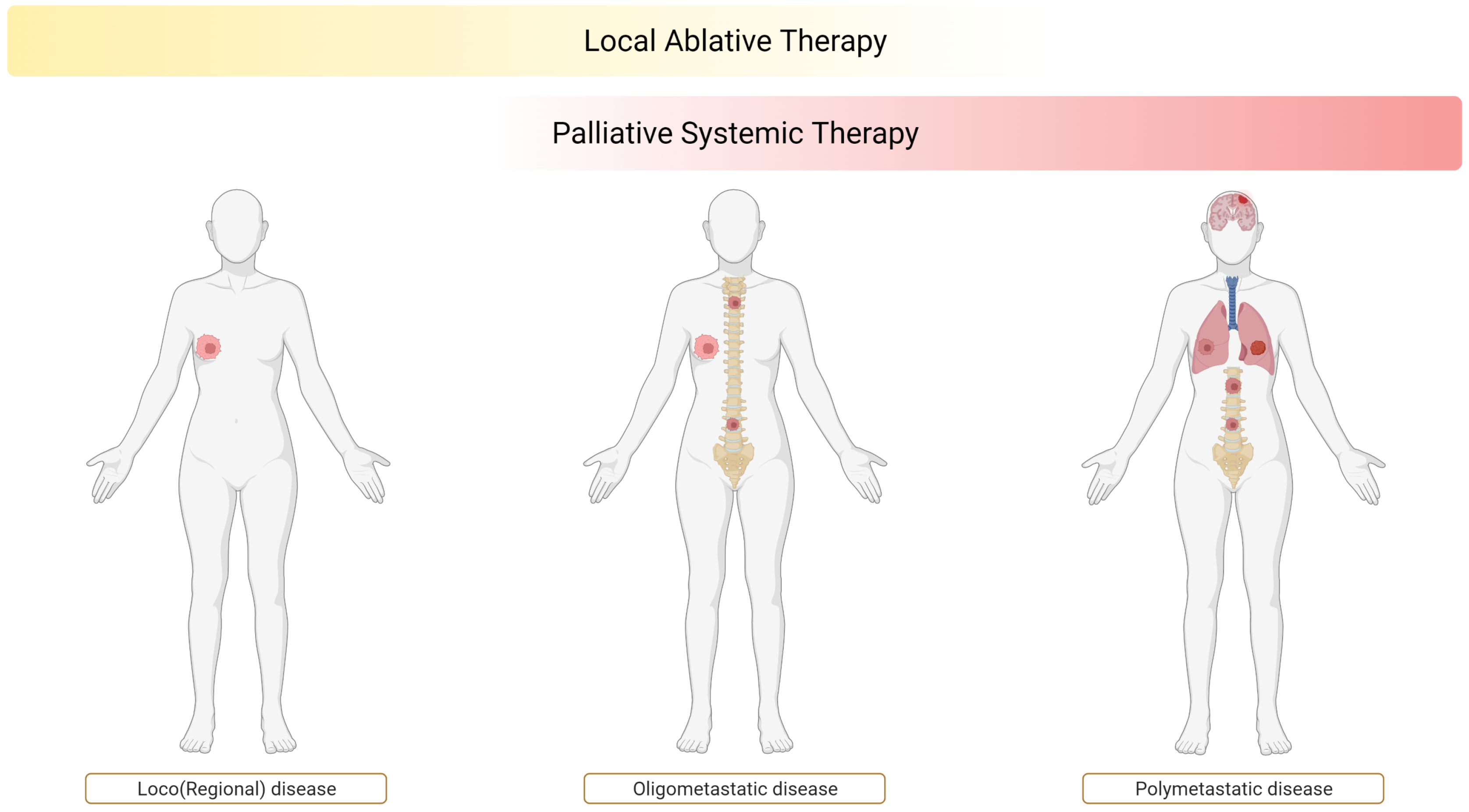 Cancers 14 02046 g001