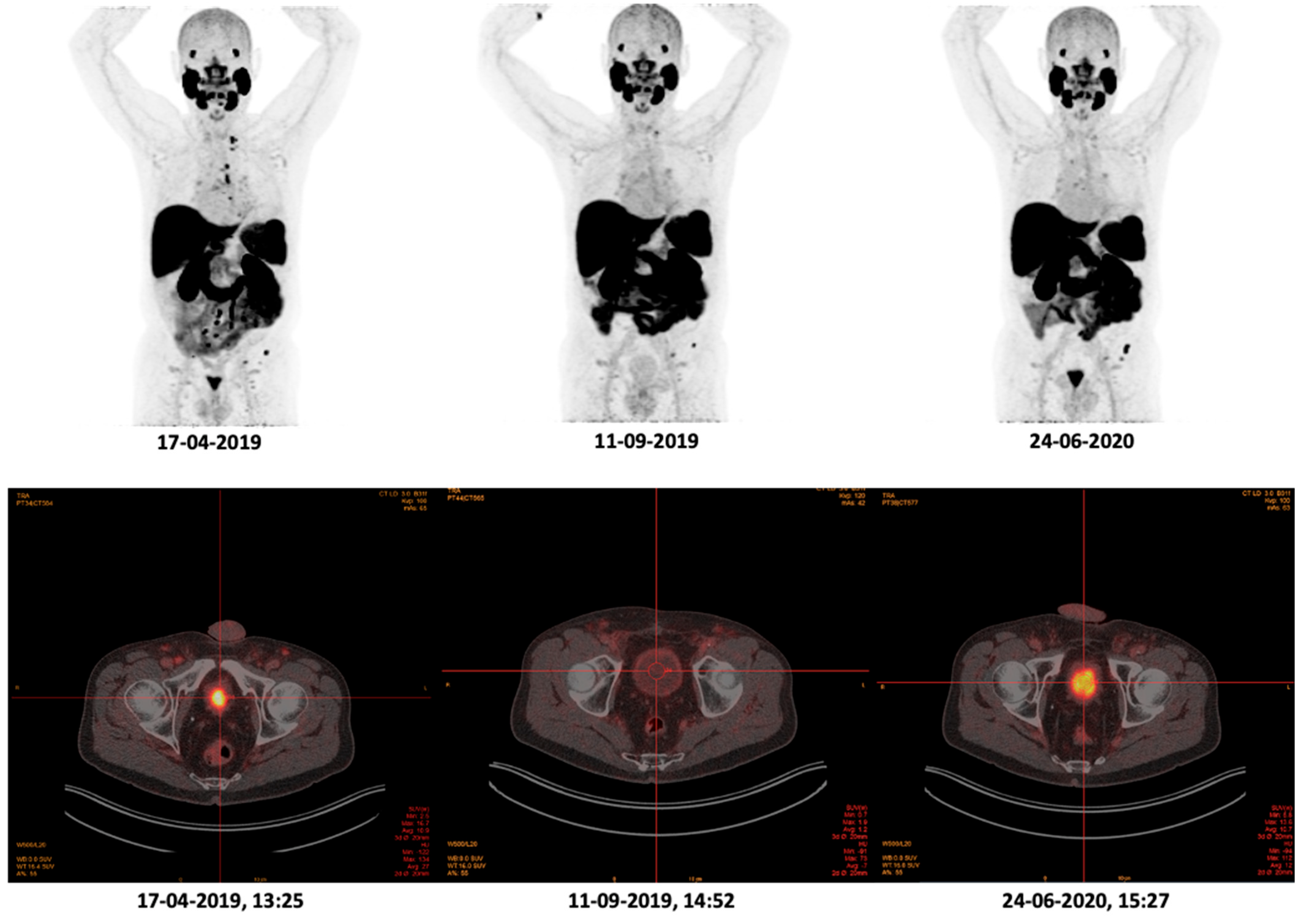 Cancers 14 02076 g002 550