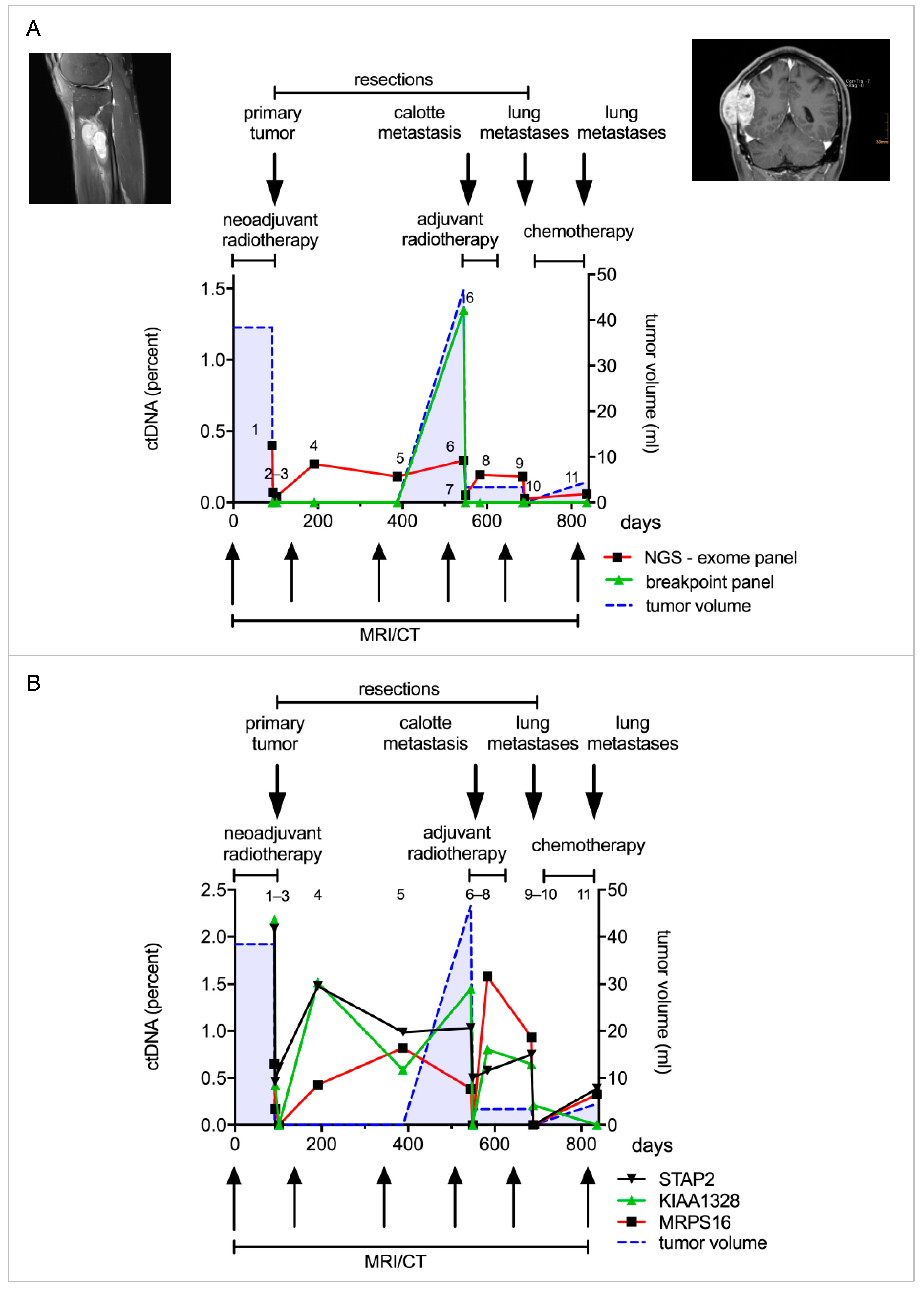 Cancers 14 02078 g004 Cancers 14 02078 g004