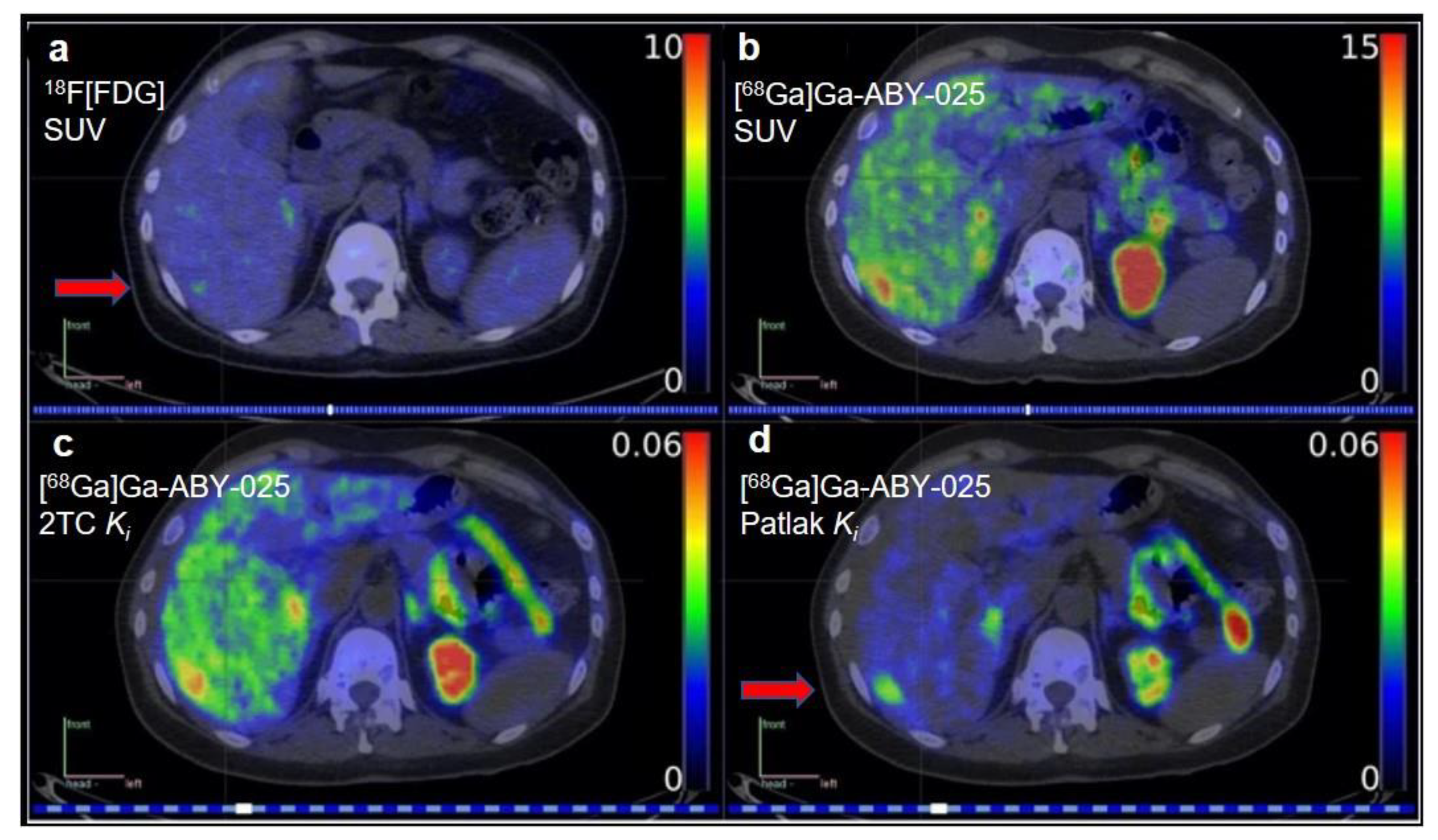 Diagnostic Breast Imaging 第2版 Women's Imaging Services | Second Read | Artificial