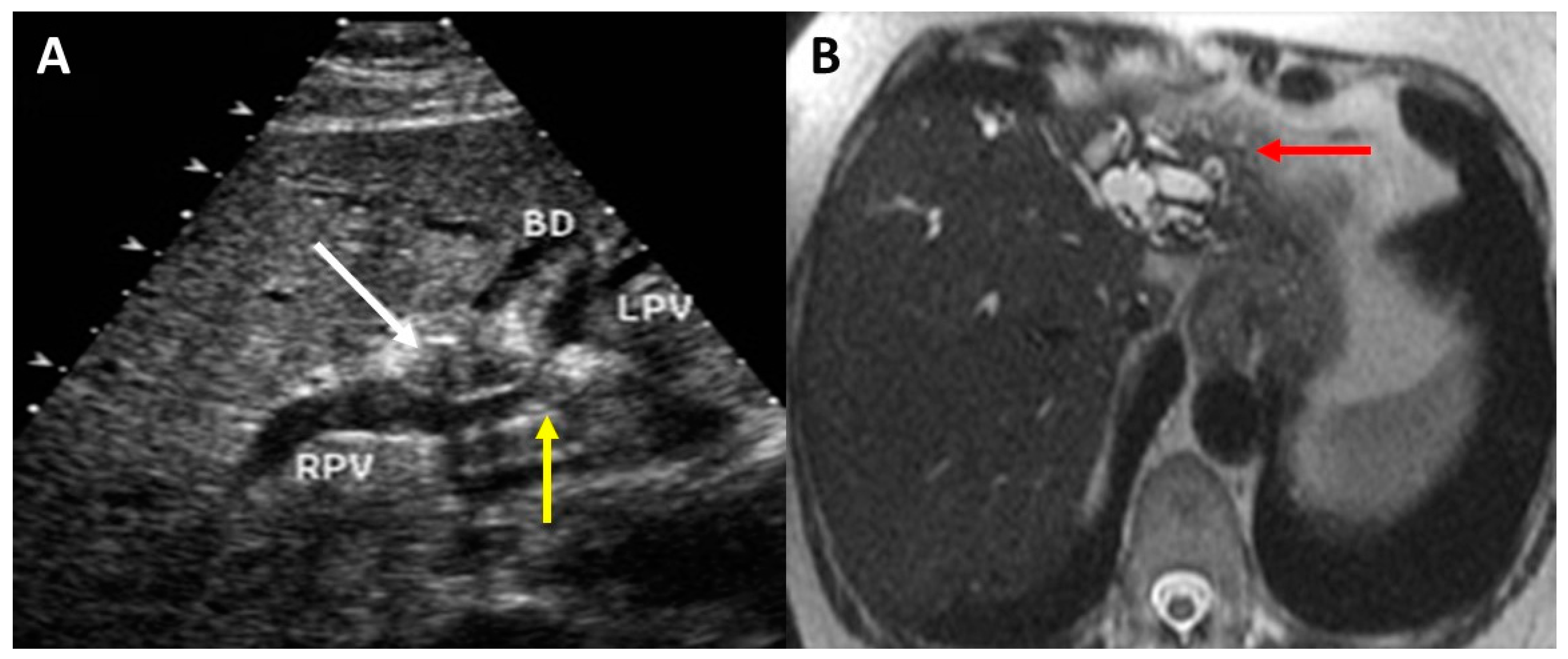 Cancers 14 02119 g001