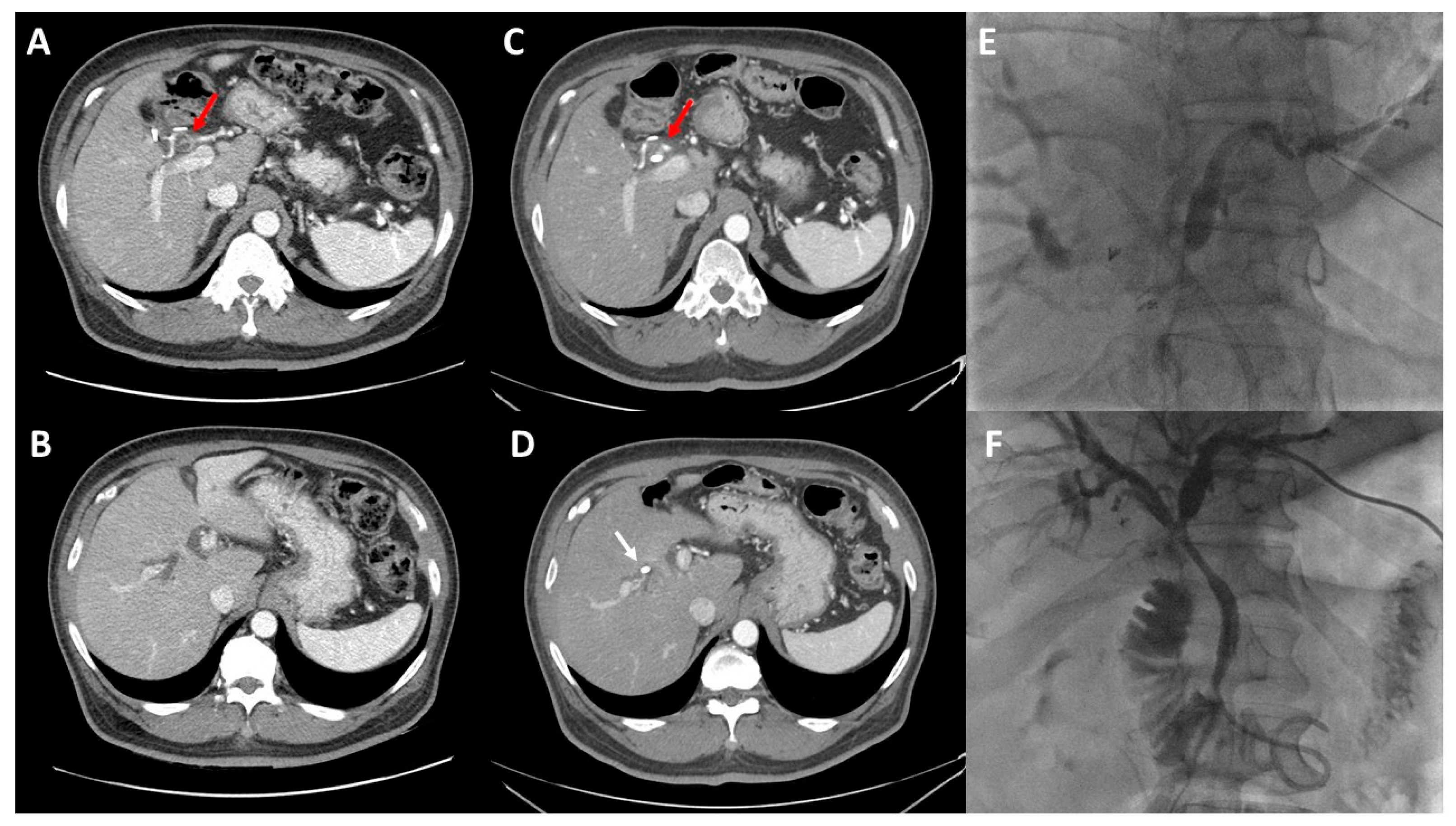 Cancers 14 02119 g002