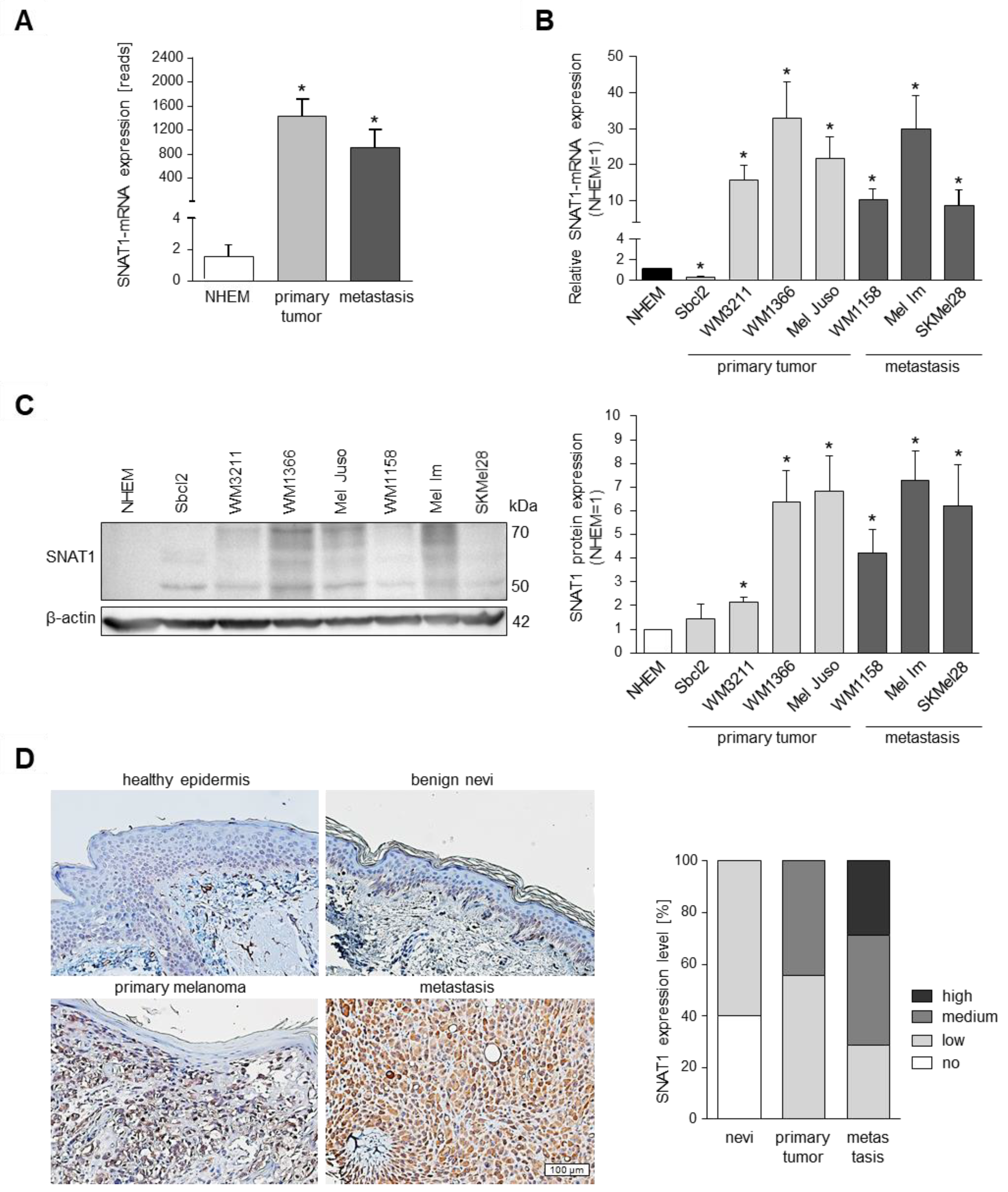 Role of Amino Acid Transporter SNAT1/SLC38A1 in Human Melanoma