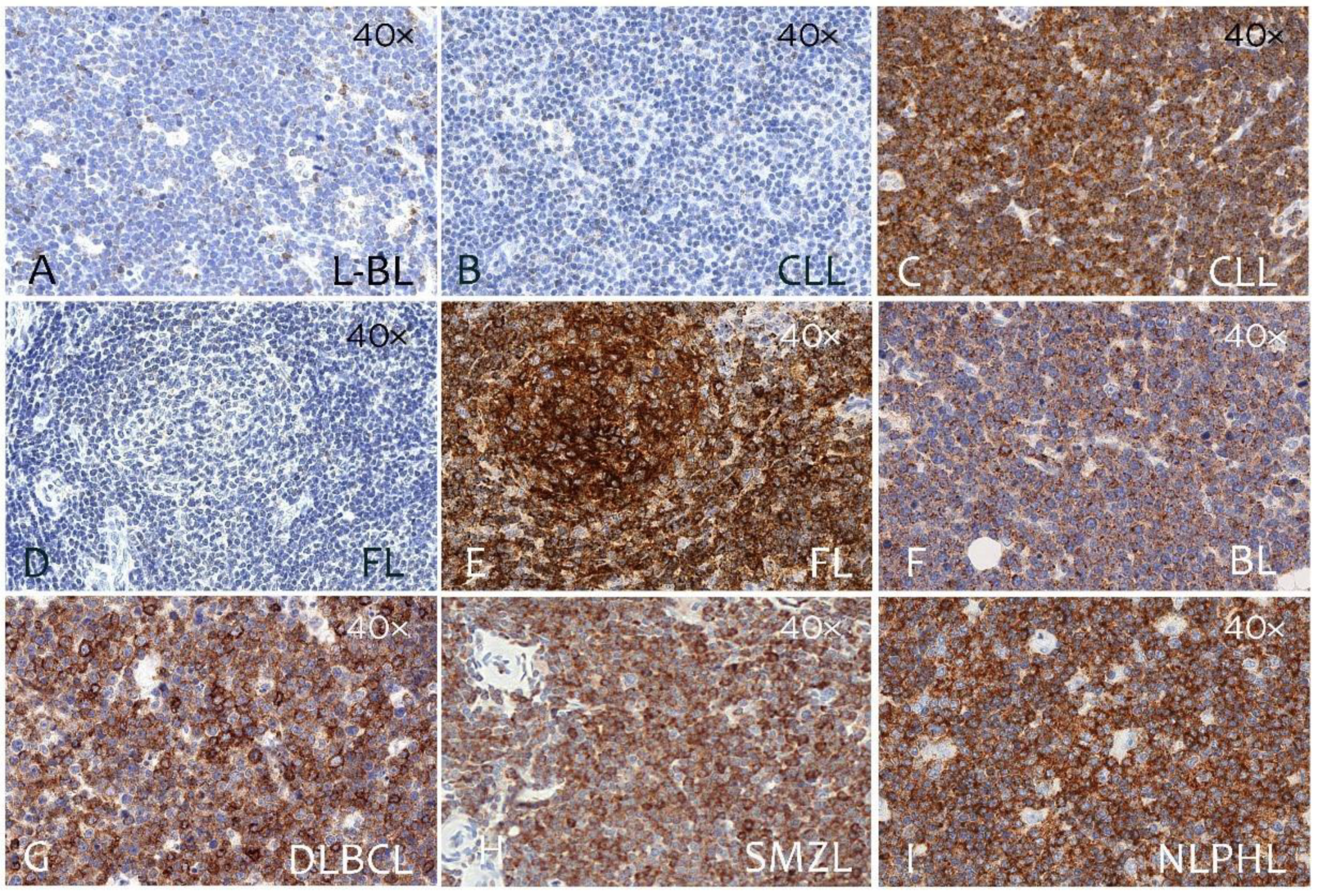 Cancers 14 02154 g004