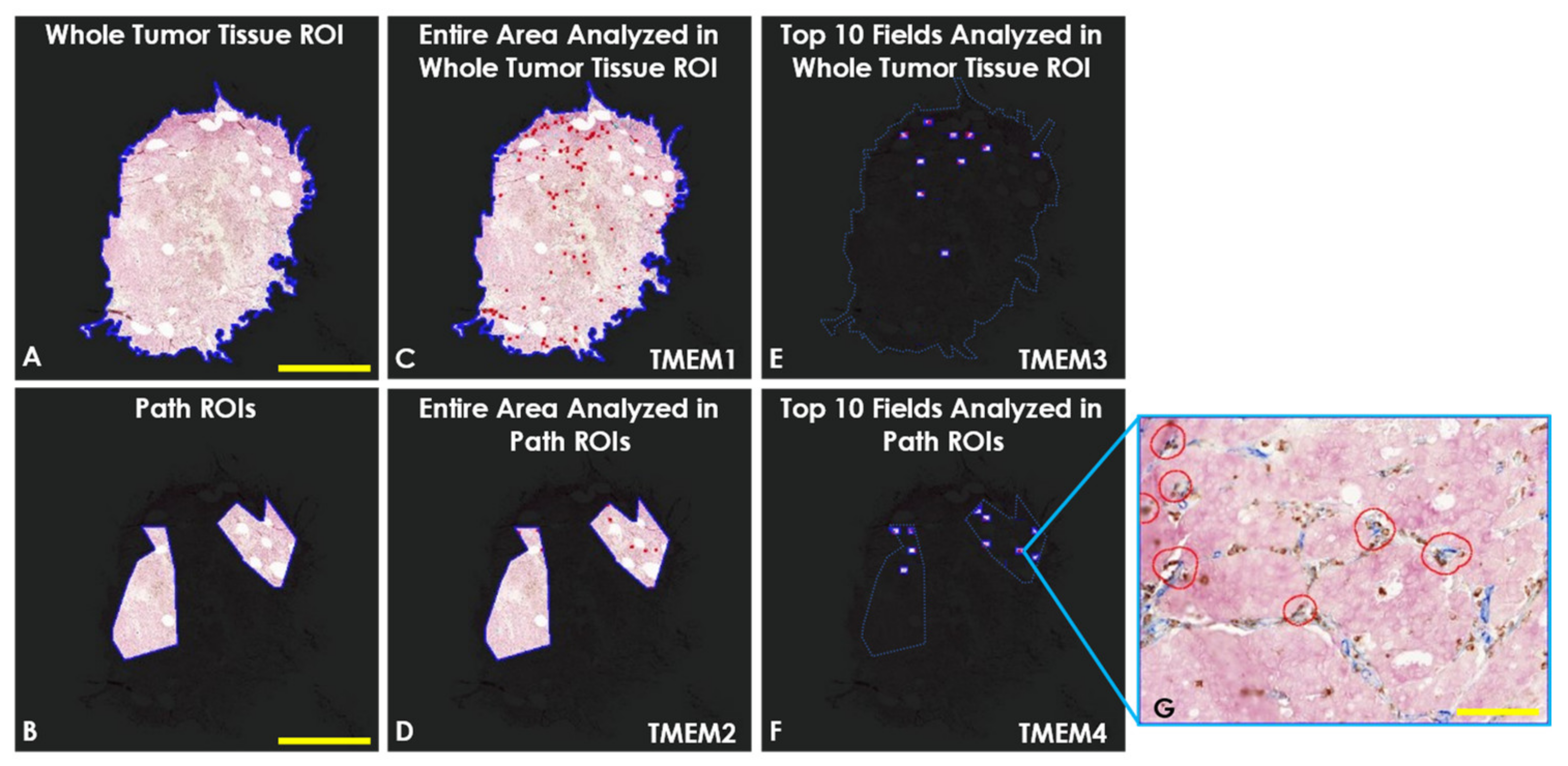 Cancers 14 02168 g002