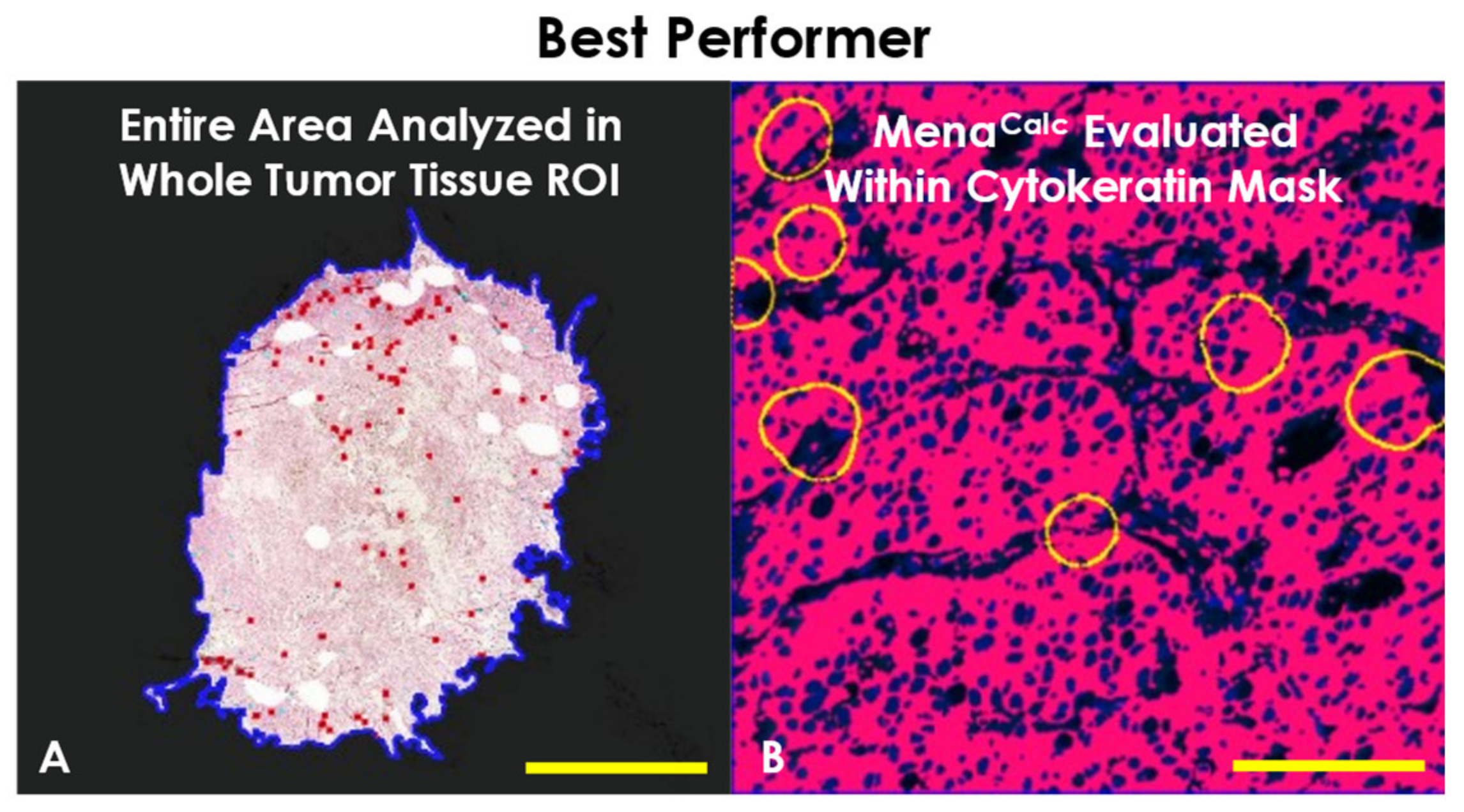 Cancers 14 02168 g006