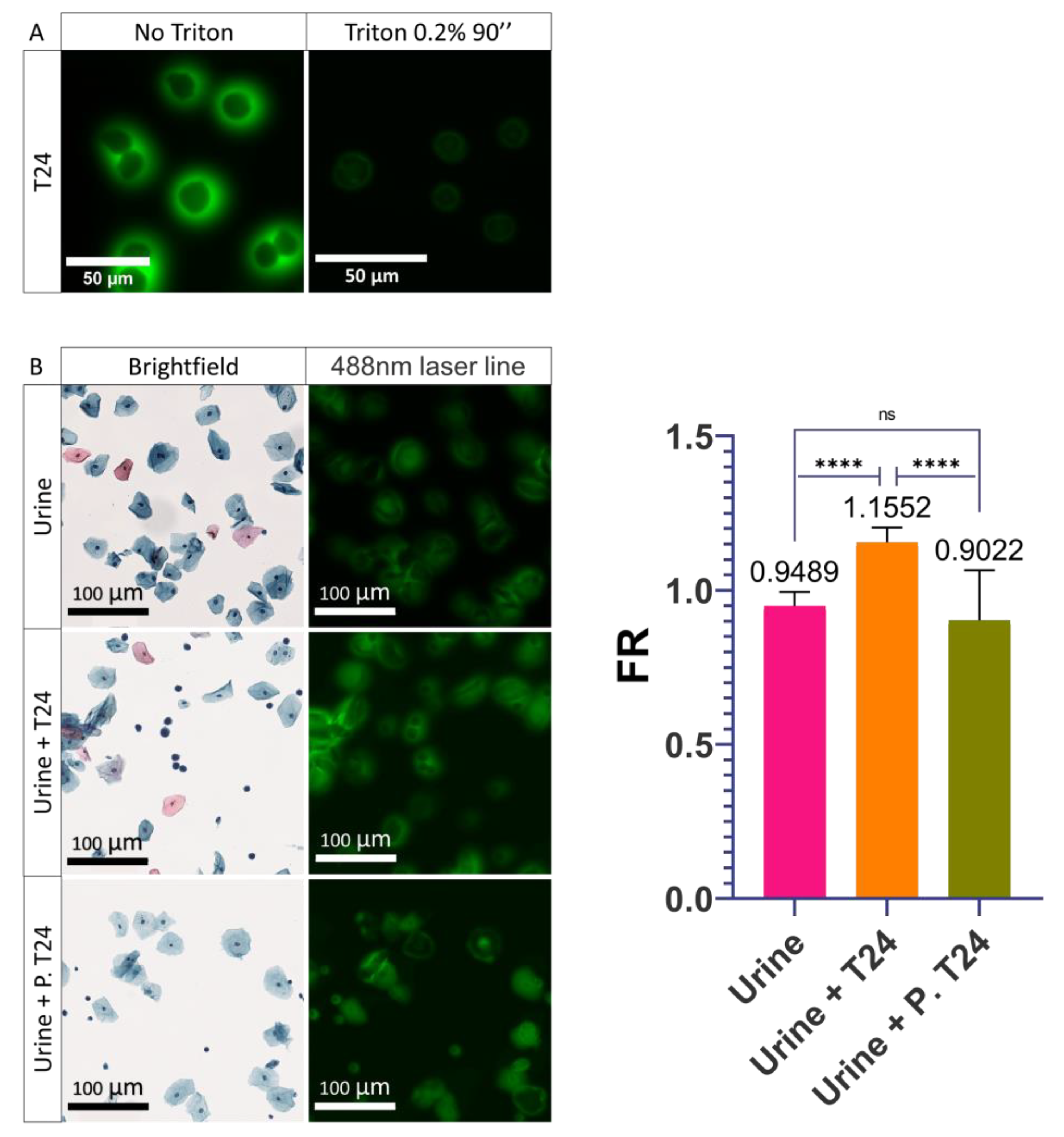 Cancers 14 02171 g004