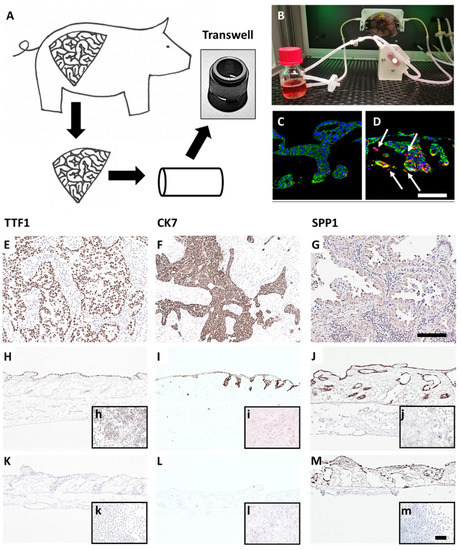 EMT, Stemness, and Drug Resistance in Biological Context: A