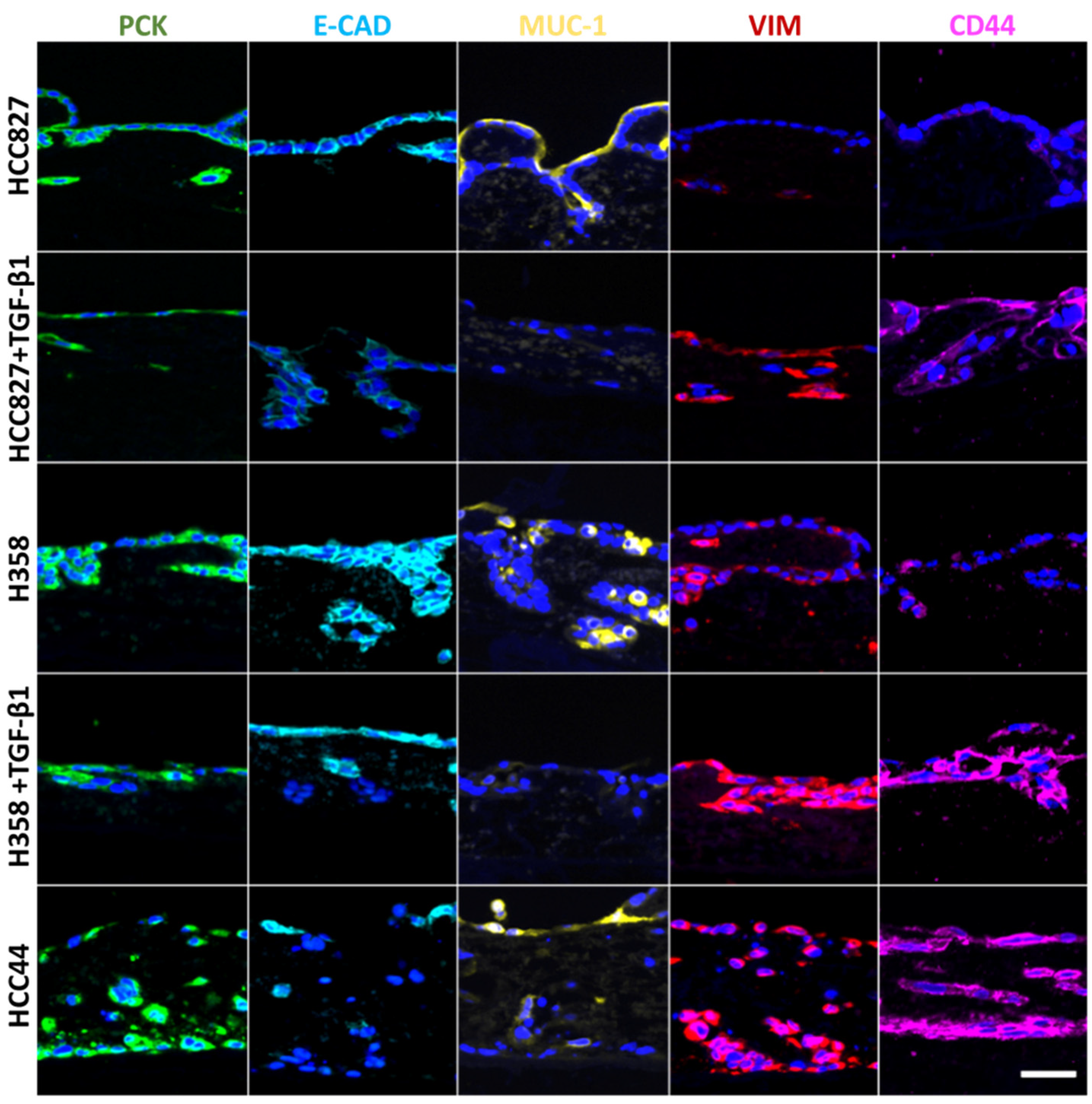 Cancers 14 02176 g002 Cancers 14 02176 g002