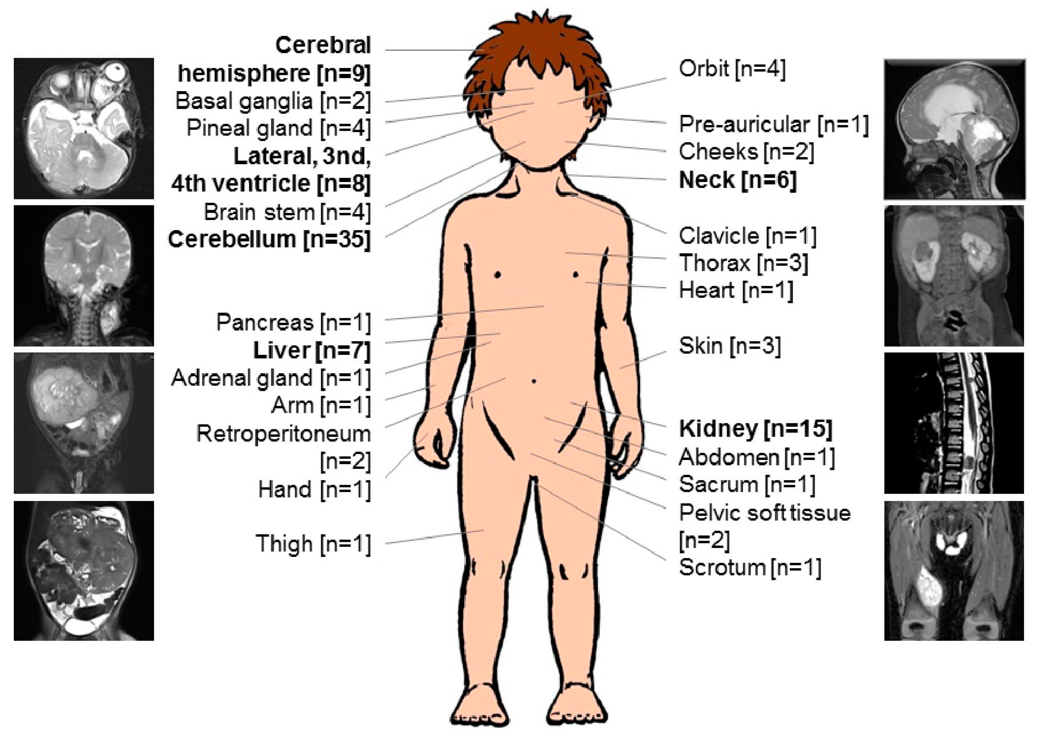 Cancers 14 02185 g001