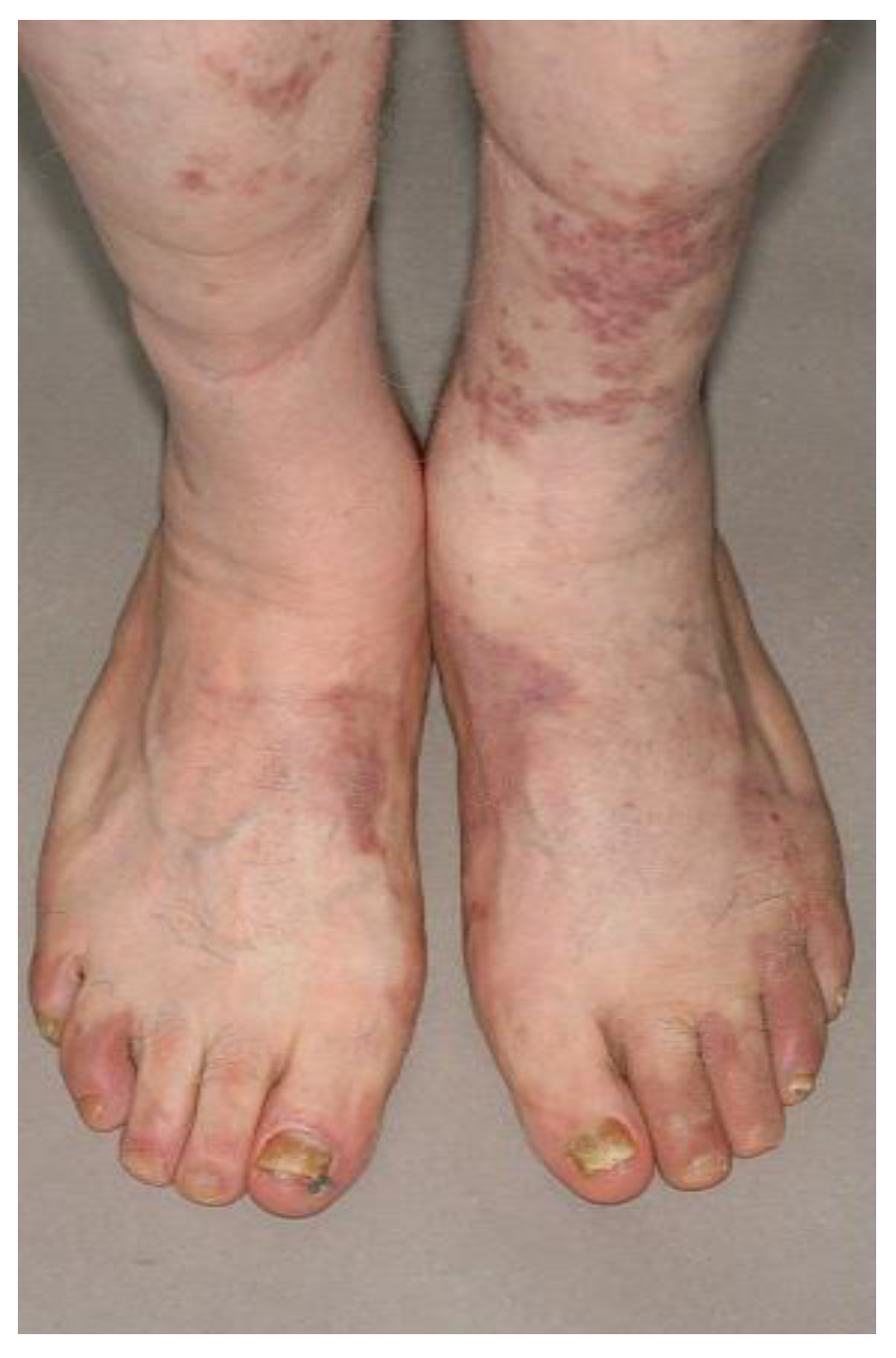 Cancers 14 02189 g001 550