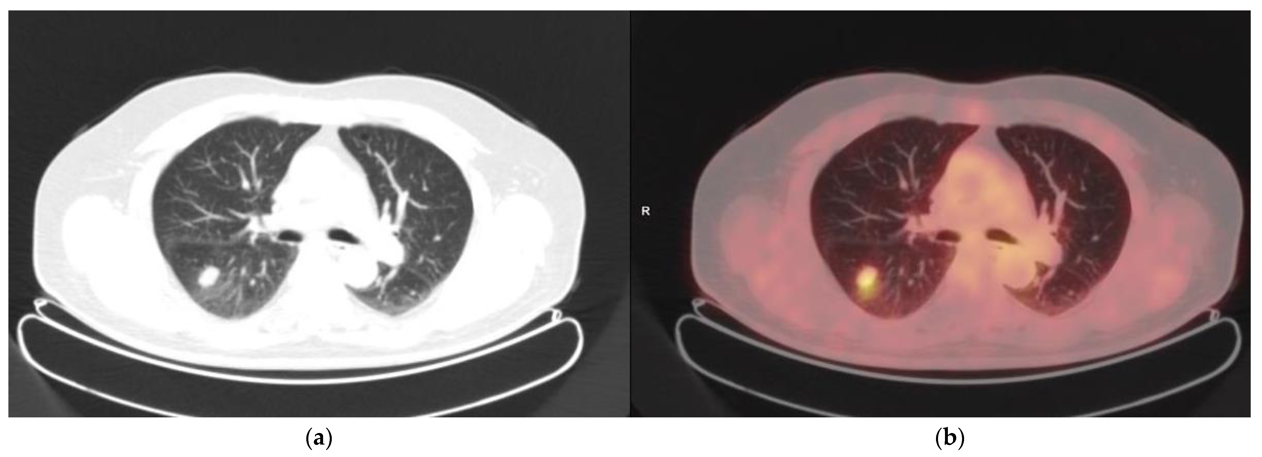 Cancers 14 02189 g002 550