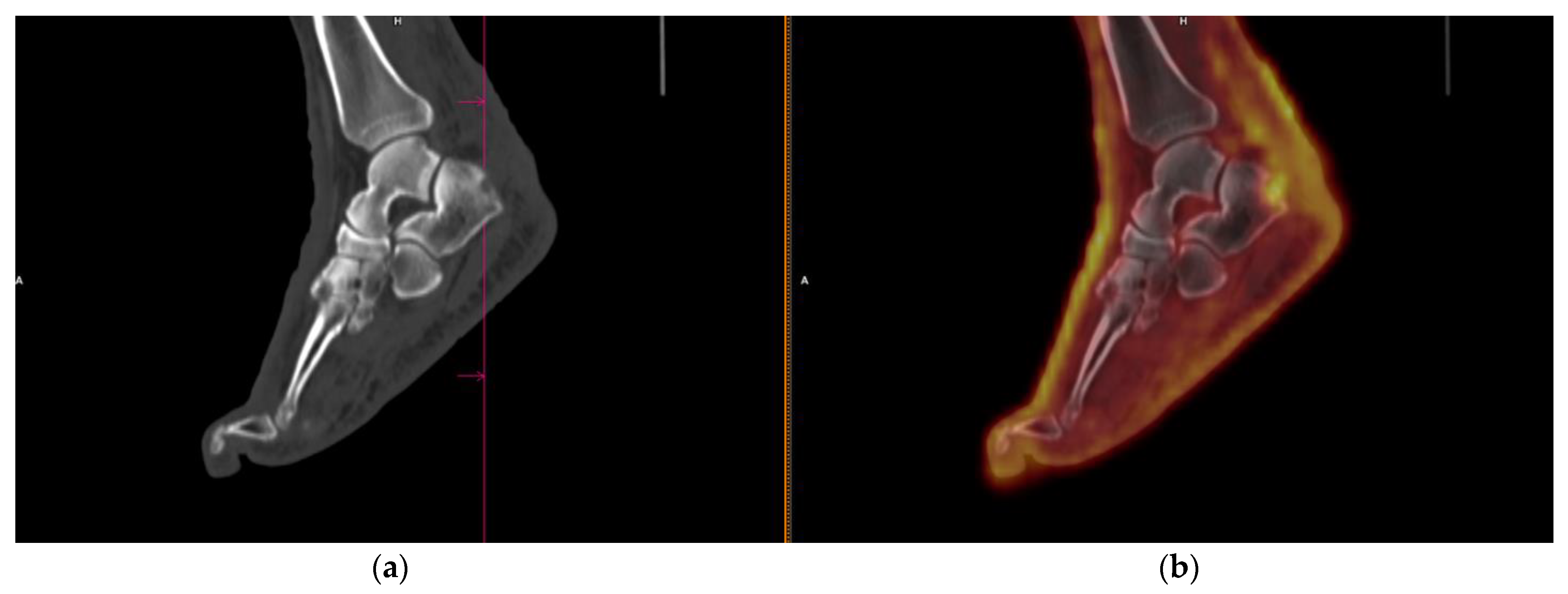 Cancers 14 02189 g003 550