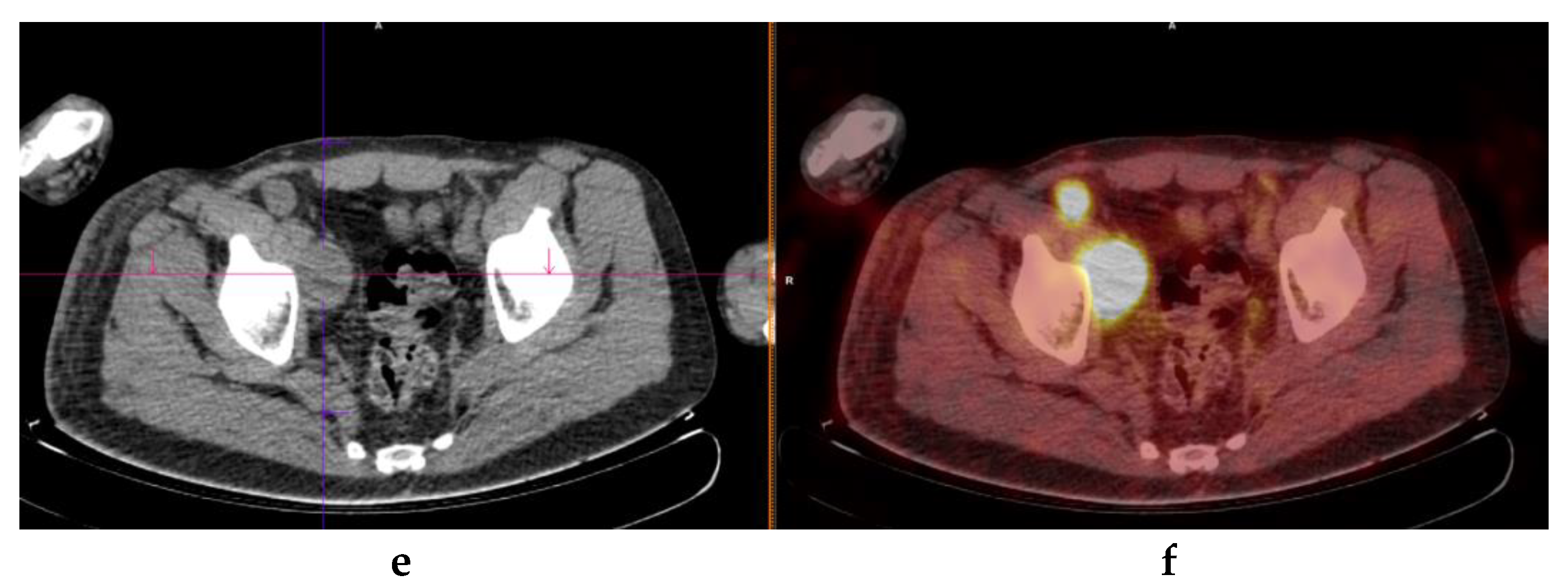 Cancers 14 02189 g004b 550