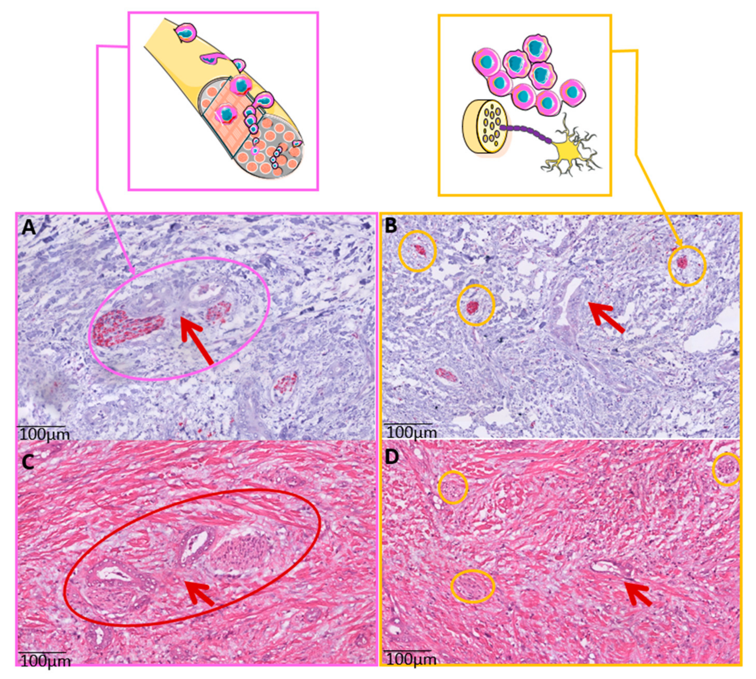 Cancers 14 02190 g001 550