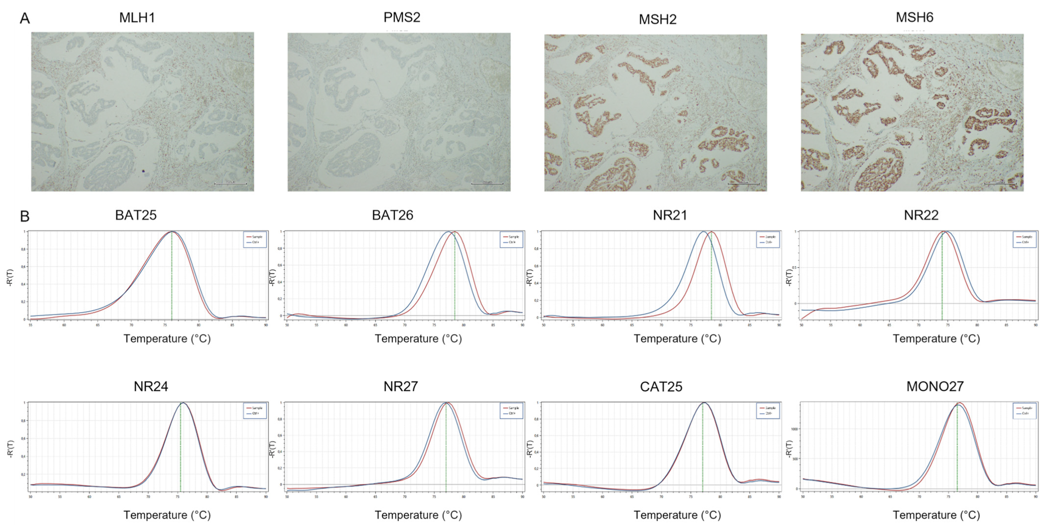 Cancers 14 02204 g006