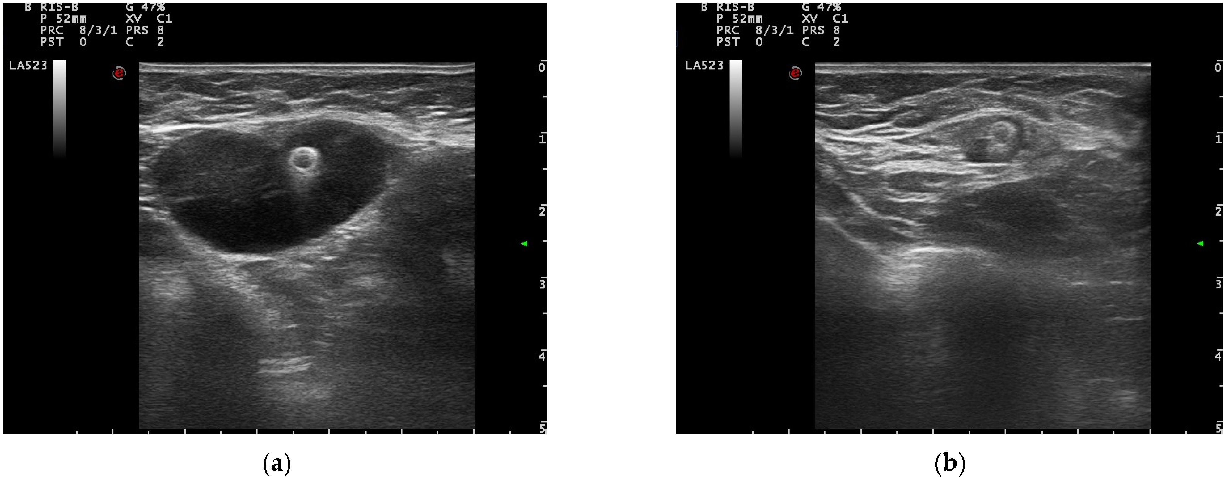 Cancers 14 02229 g003 550