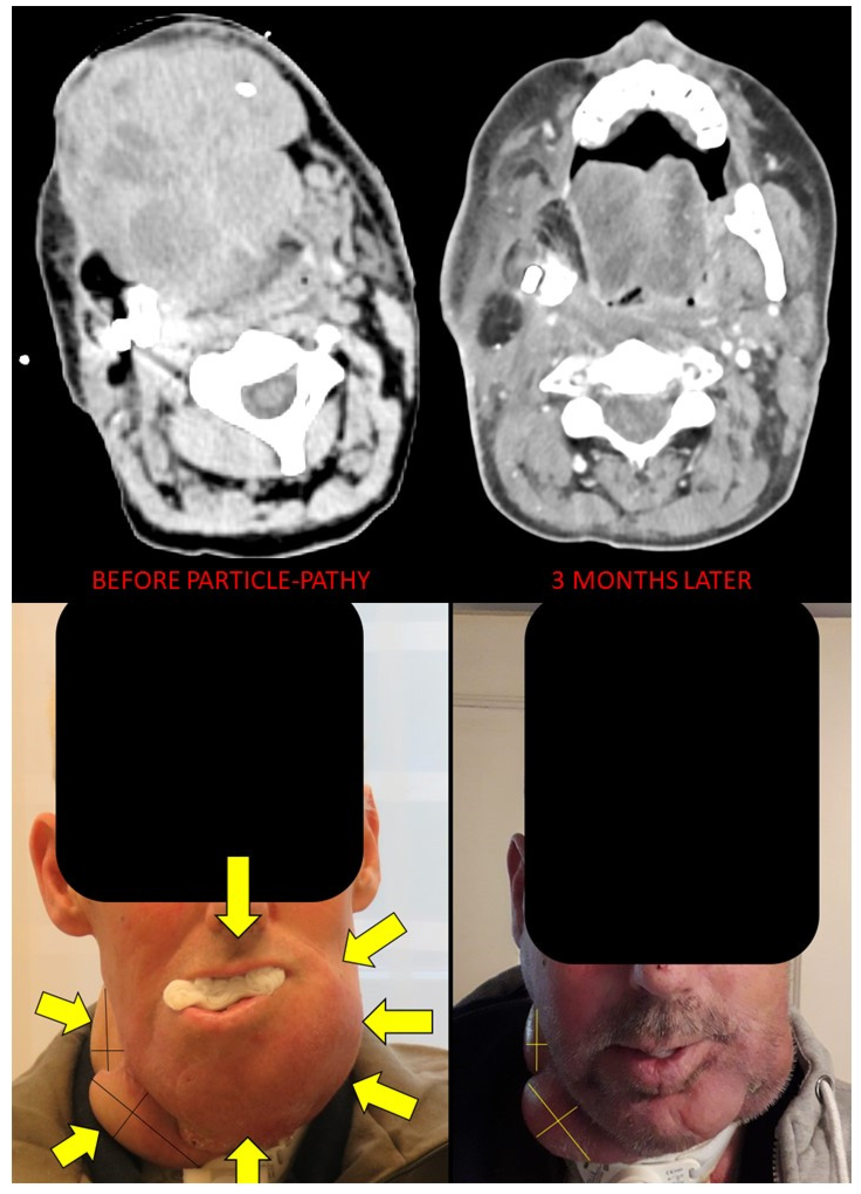 Cancers 14 02232 g006 550