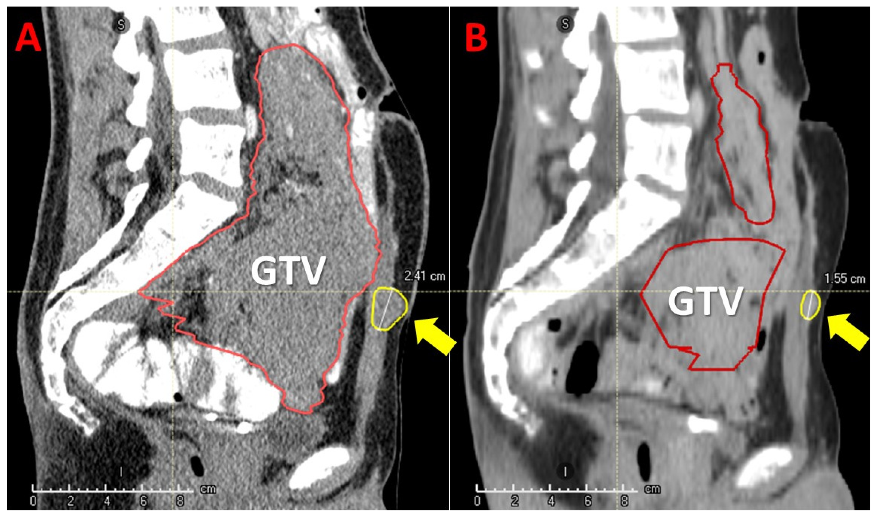 Cancers 14 02232 g008 550