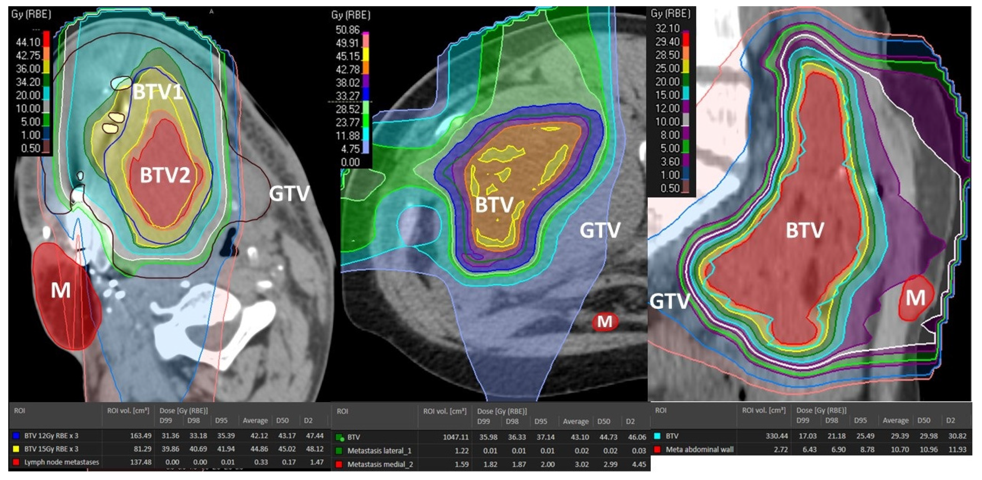 Cancers 14 02232 g009 550