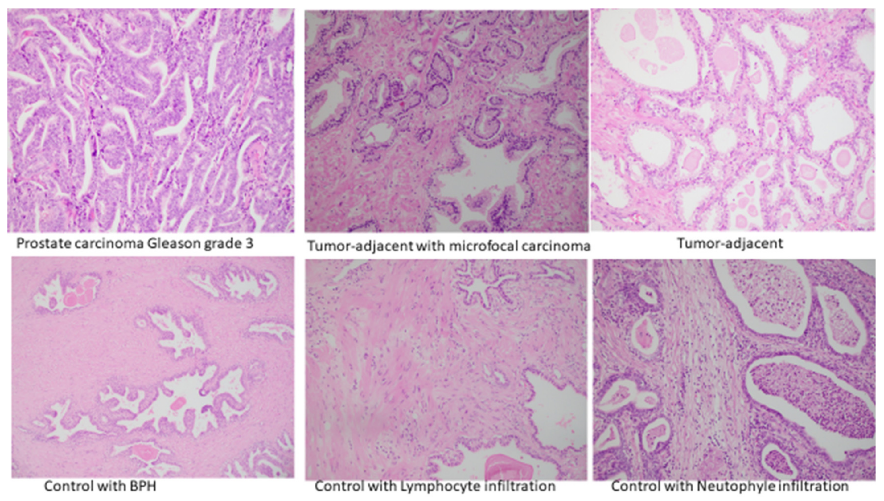 Cancers 14 02239 g008